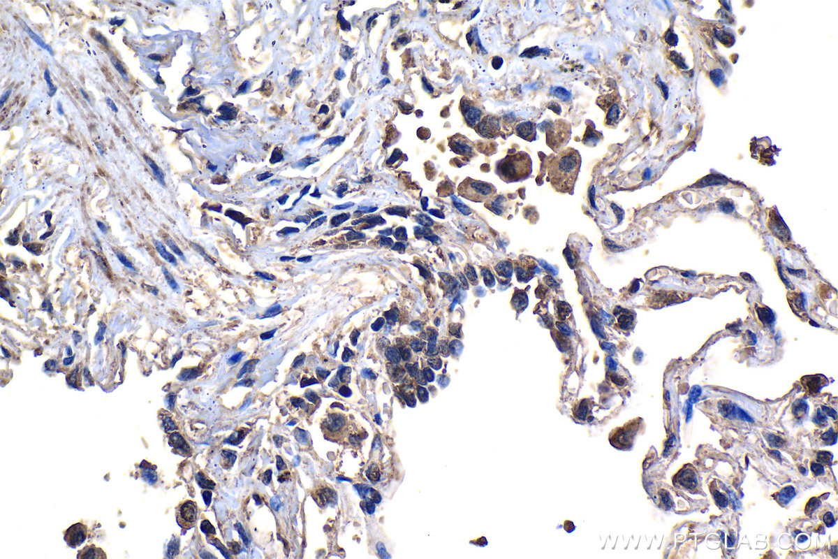 Immunohistochemistry (IHC) staining of human lung tissue using CFTR Monoclonal antibody (66928-1-Ig)