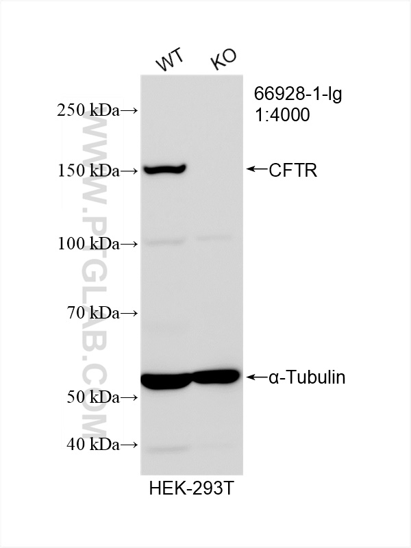 Western Blot (WB) analysis of various lysates using CFTR Monoclonal antibody (66928-1-Ig)