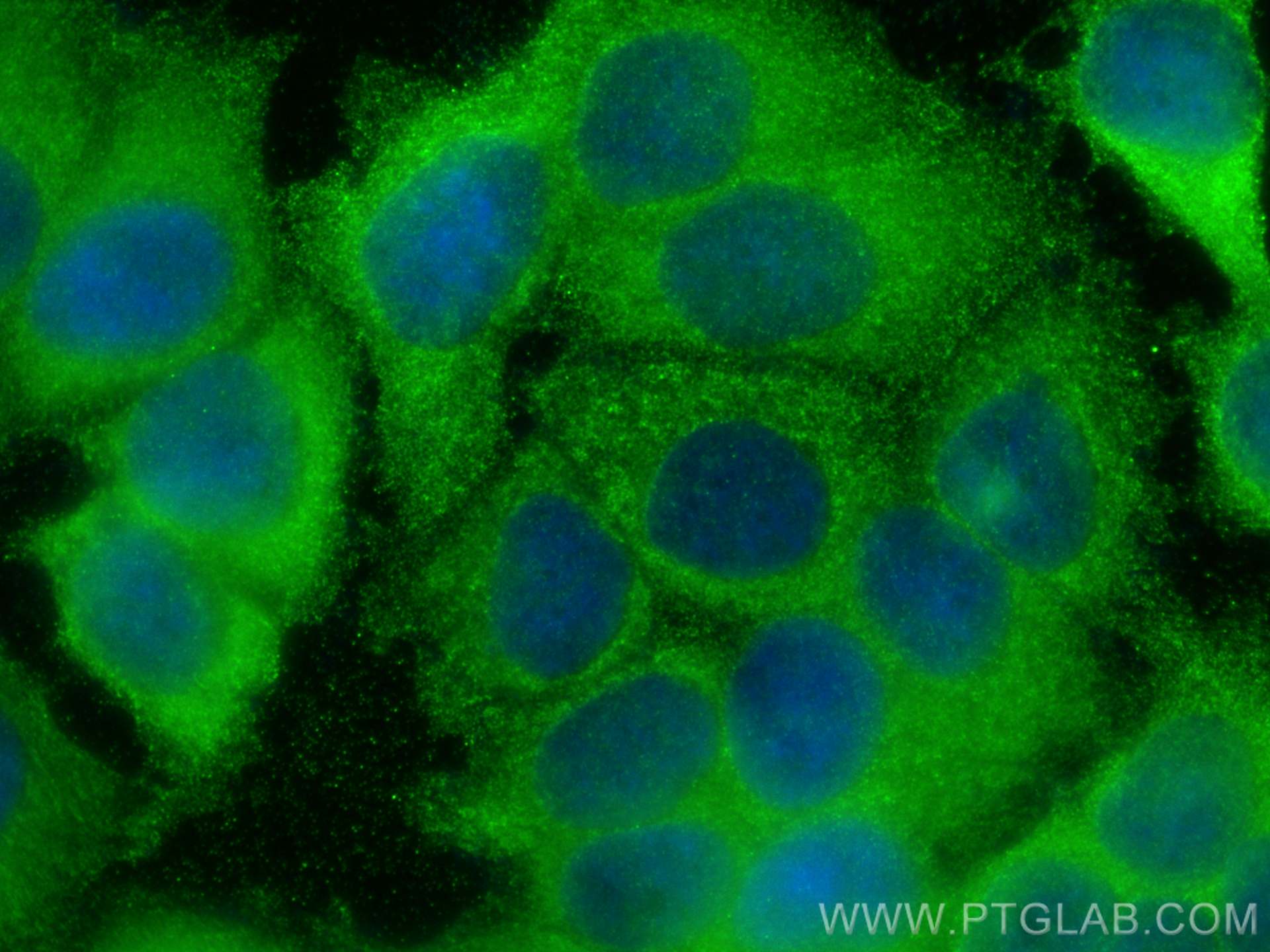 Immunofluorescence (IF) / fluorescent staining of MCF-7 cells using CHAC2 Polyclonal antibody (16304-1-AP)