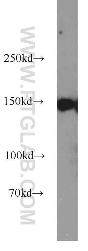 Western Blot (WB) analysis of Jurkat cells using CHAF1A Polyclonal antibody (17037-1-AP)