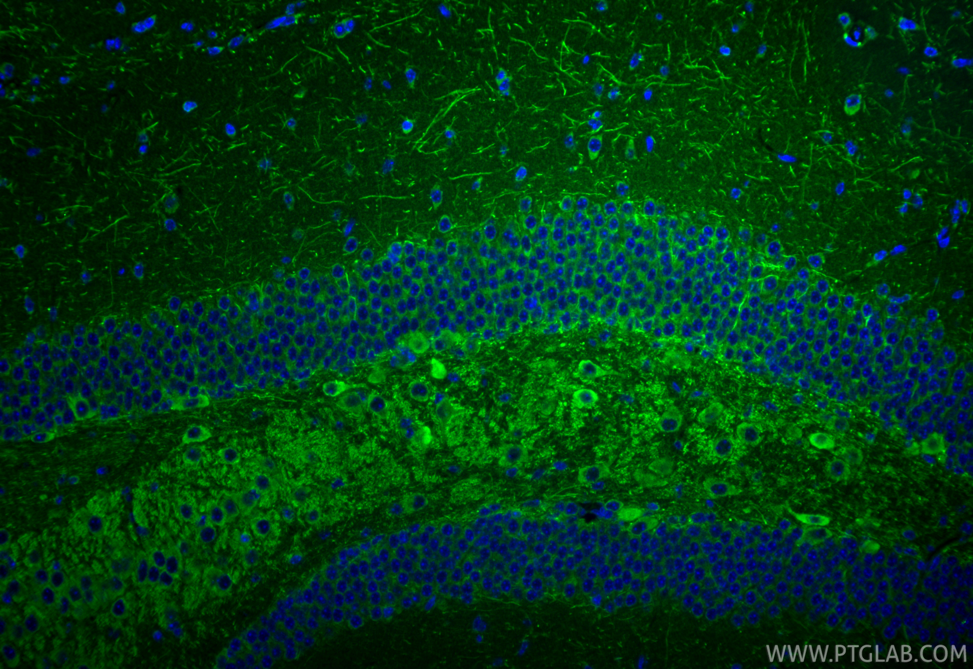 Immunofluorescence (IF) / fluorescent staining of mouse brain tissue using CHAT Polyclonal antibody (20747-1-AP)