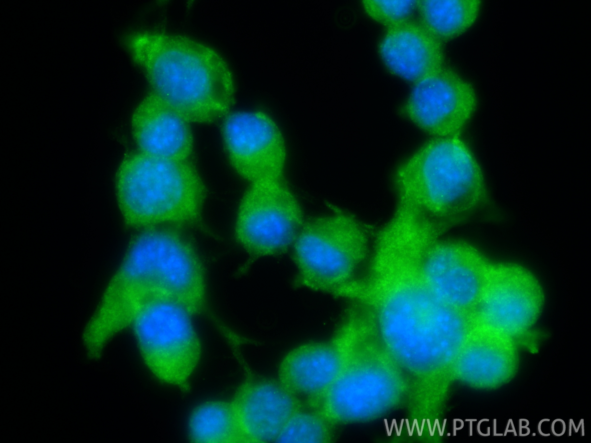 Immunofluorescence (IF) / fluorescent staining of Neuro-2a cells using CHAT Polyclonal antibody (20747-1-AP)