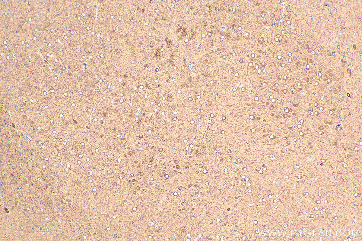 Immunohistochemistry (IHC) staining of rat brain tissue using CHAT Polyclonal antibody (20747-1-AP)