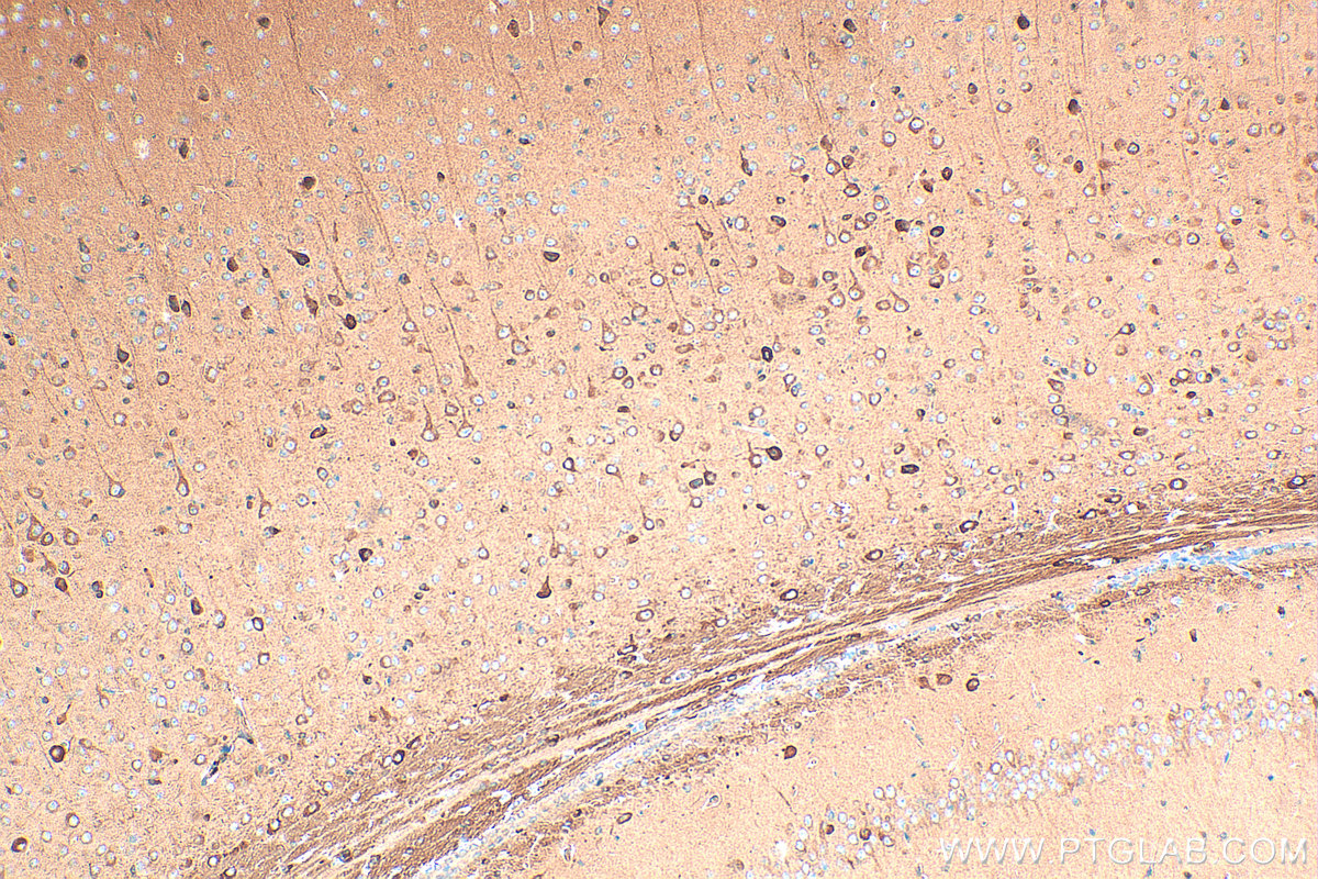 Immunohistochemistry (IHC) staining of mouse brain tissue using CHAT Polyclonal antibody (20747-1-AP)