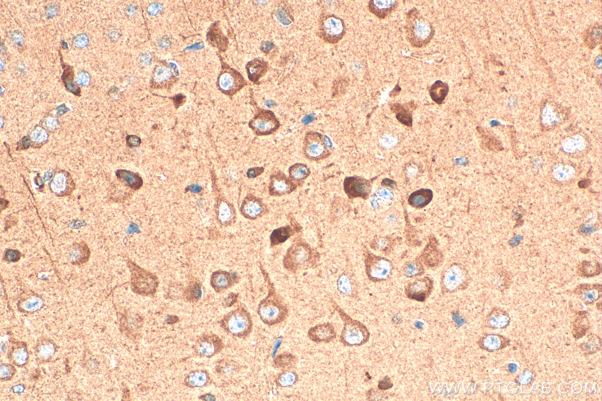 Immunohistochemistry (IHC) staining of mouse brain tissue using CHAT Polyclonal antibody (20747-1-AP)