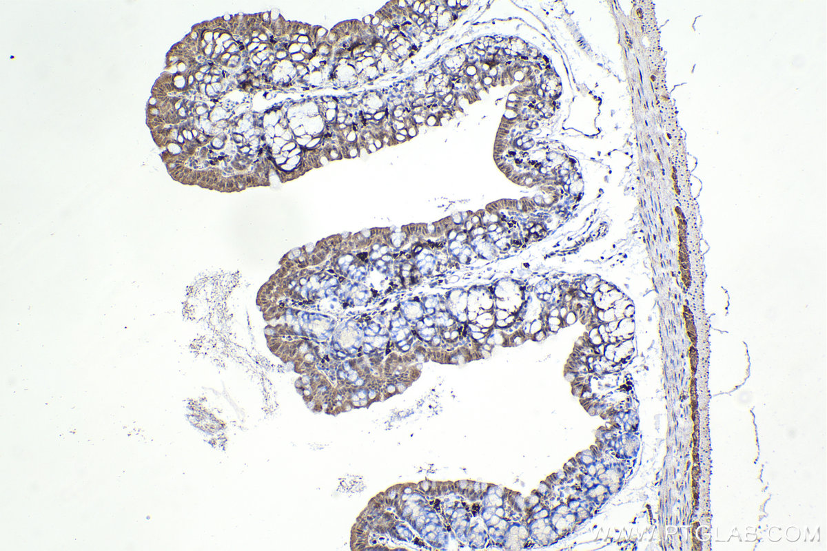 Immunohistochemistry (IHC) staining of mouse small intestine tissue using CHAT Monoclonal antibody (66816-1-Ig)