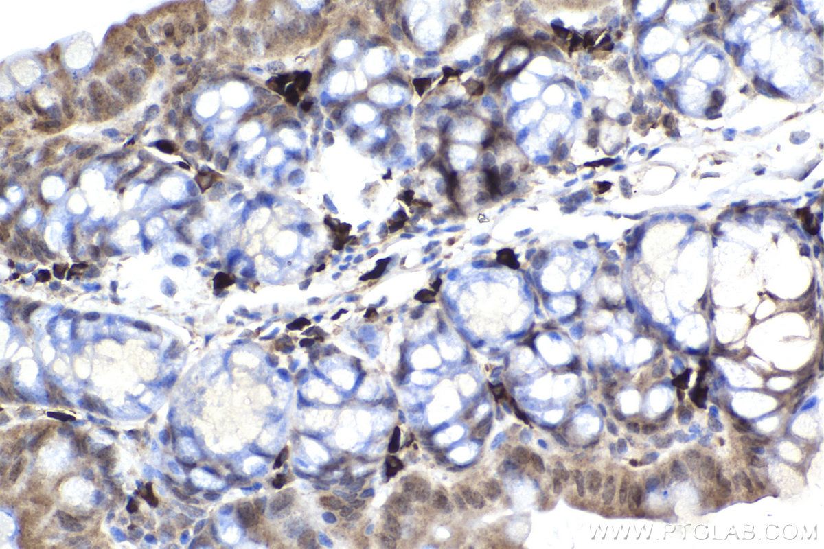 Immunohistochemistry (IHC) staining of mouse small intestine tissue using CHAT Monoclonal antibody (66816-1-Ig)