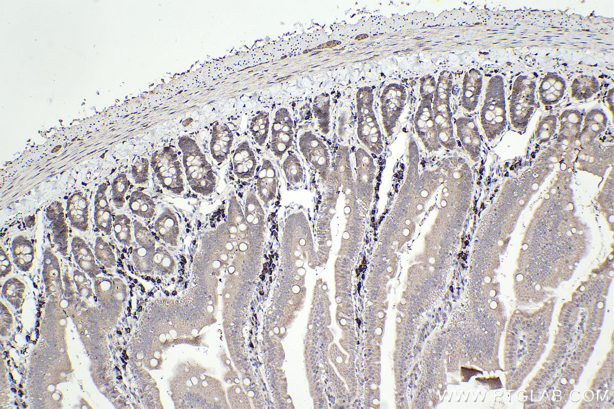 Immunohistochemistry (IHC) staining of rat small intestine tissue using CHAT Monoclonal antibody (66816-1-Ig)