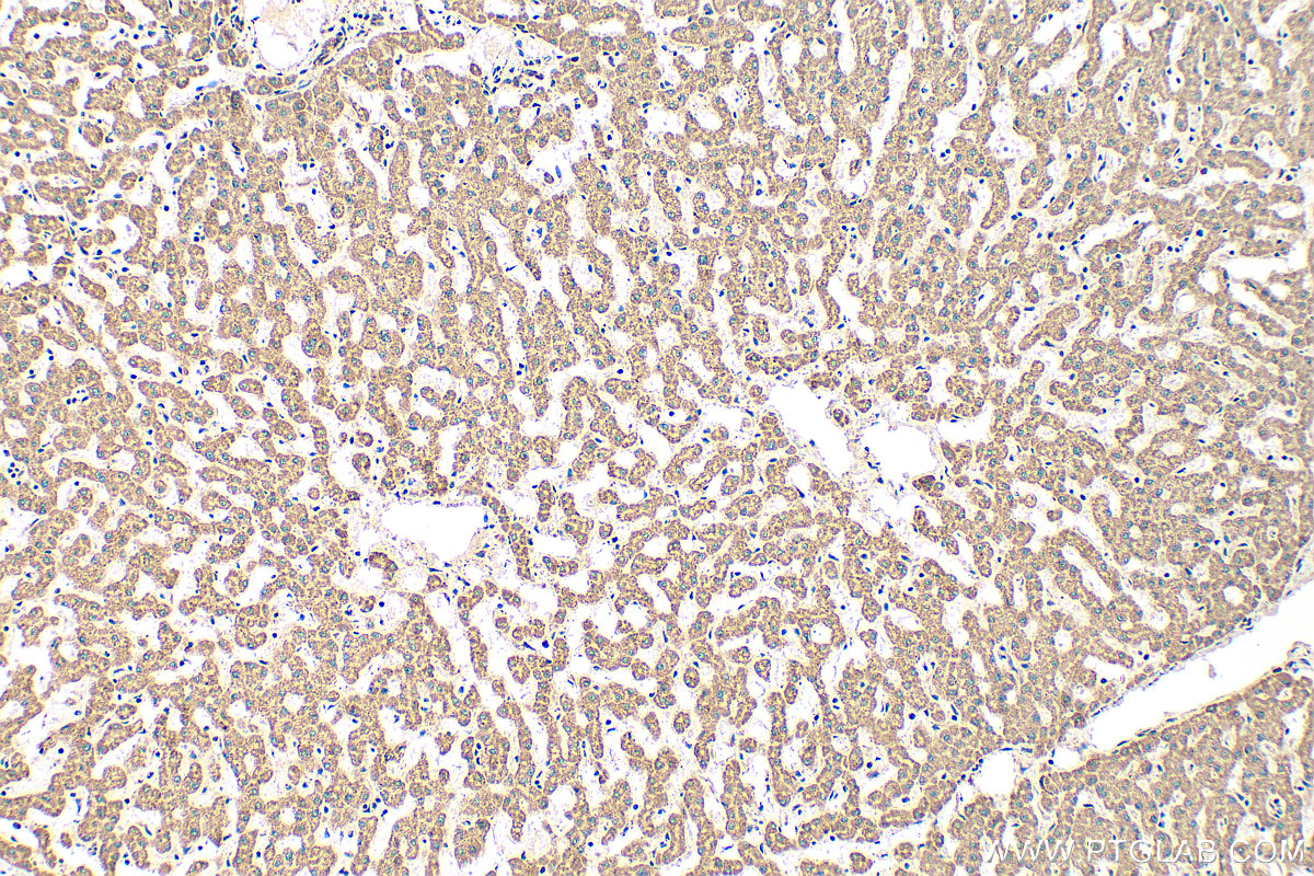 Immunohistochemistry (IHC) staining of human liver tissue using CHCHD3/MIC19 Polyclonal antibody (25625-1-AP)