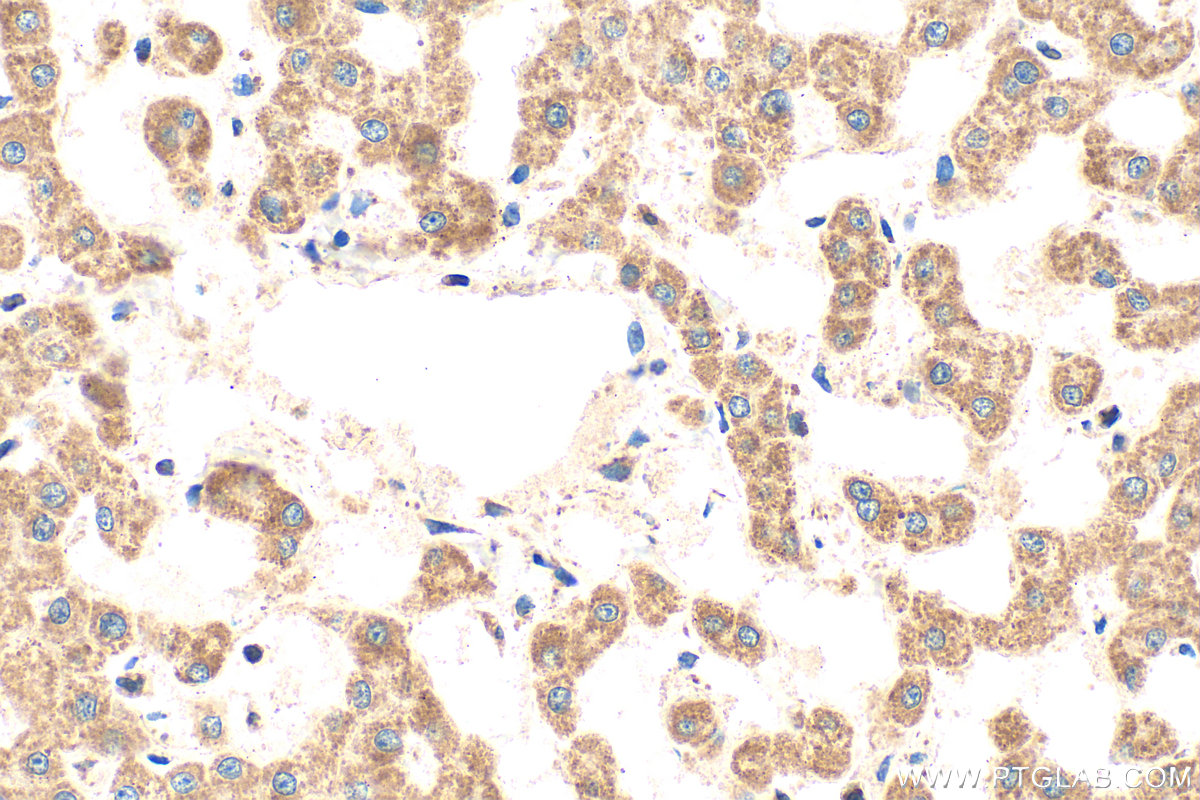 Immunohistochemistry (IHC) staining of human liver tissue using CHCHD3/MIC19 Polyclonal antibody (25625-1-AP)