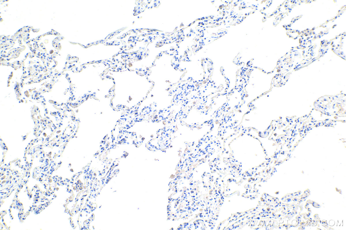 Immunohistochemistry (IHC) staining of human lung tissue using CHCHD3 Monoclonal antibody (68259-1-Ig)