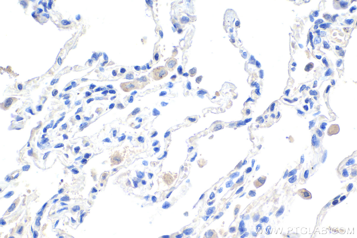 Immunohistochemistry (IHC) staining of human lung tissue using CHCHD3 Monoclonal antibody (68259-1-Ig)