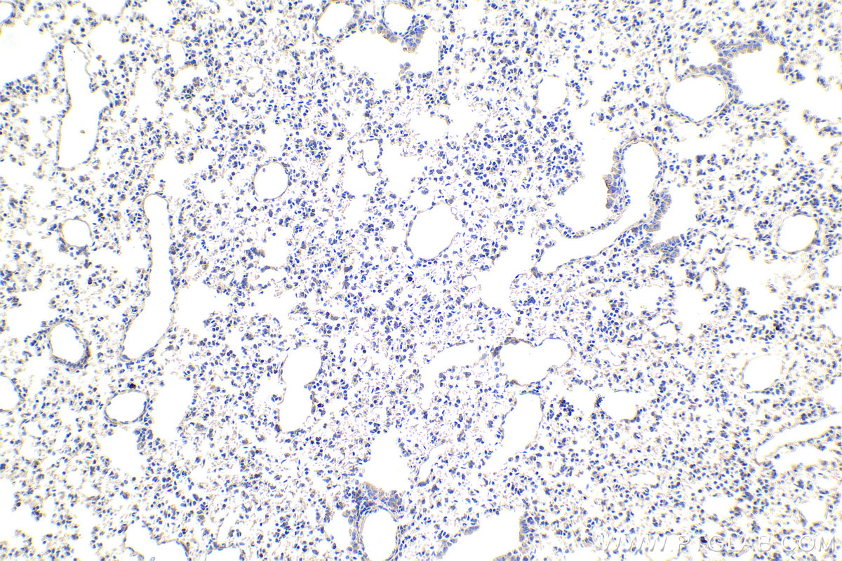 Immunohistochemistry (IHC) staining of mouse lung tissue using CHCHD3 Monoclonal antibody (68259-1-Ig)