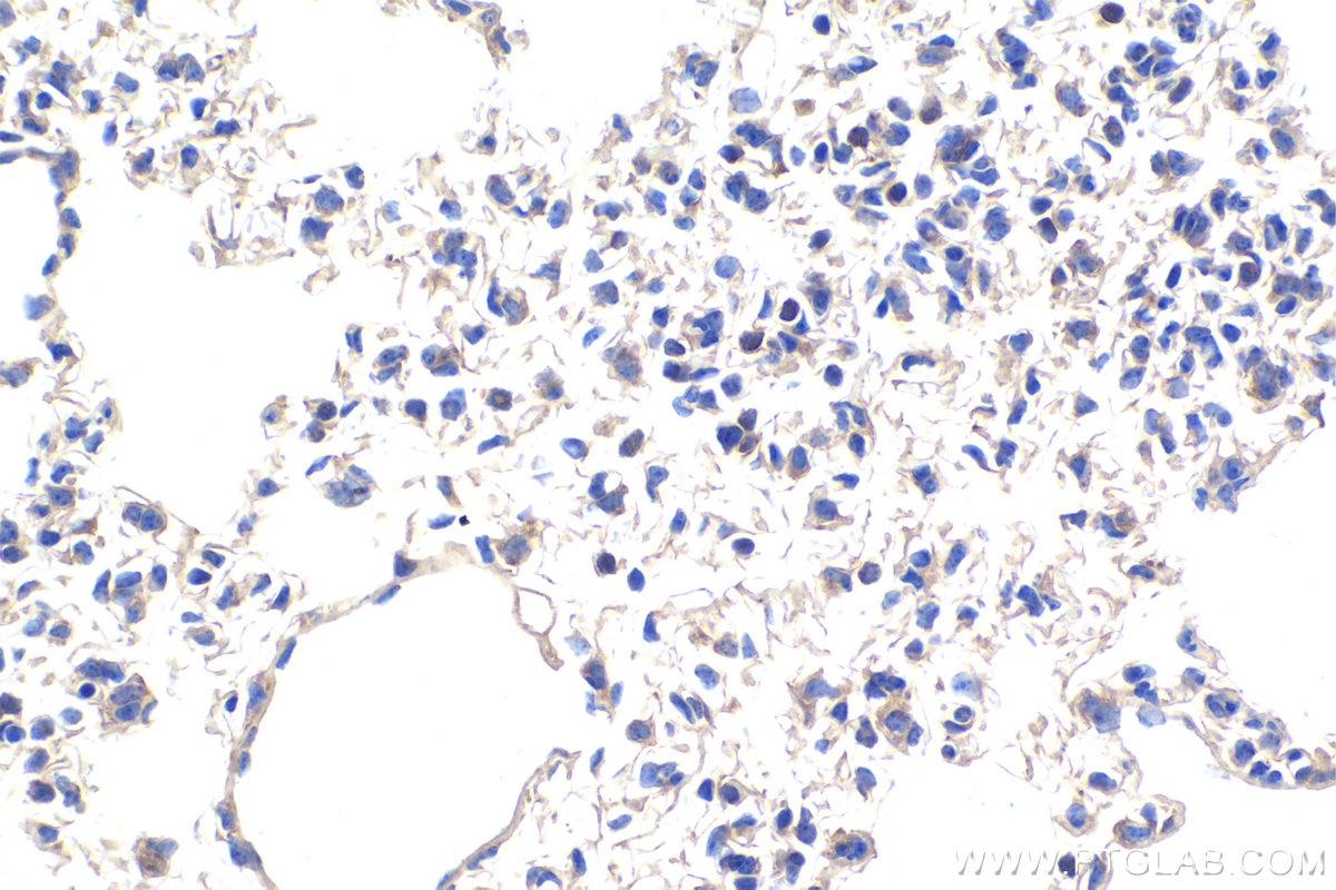 Immunohistochemistry (IHC) staining of mouse lung tissue using CHCHD3 Monoclonal antibody (68259-1-Ig)