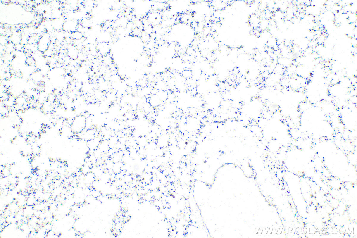 Immunohistochemistry (IHC) staining of rat lung tissue using CHCHD3 Monoclonal antibody (68259-1-Ig)