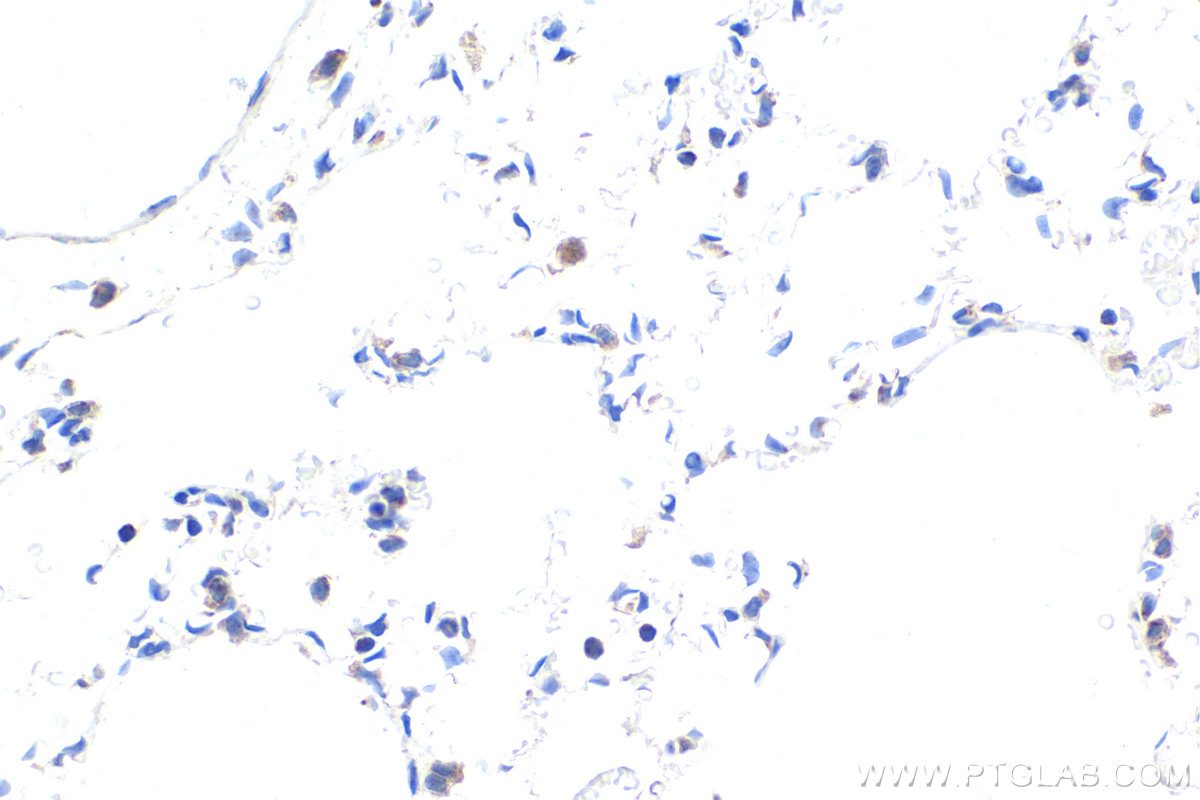 Immunohistochemistry (IHC) staining of rat lung tissue using CHCHD3 Monoclonal antibody (68259-1-Ig)