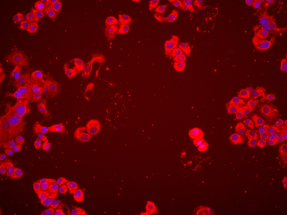 Immunofluorescence (IF) / fluorescent staining of SK-BR-3 cells using CHCHD4 Monoclonal antibody (66718-1-Ig)