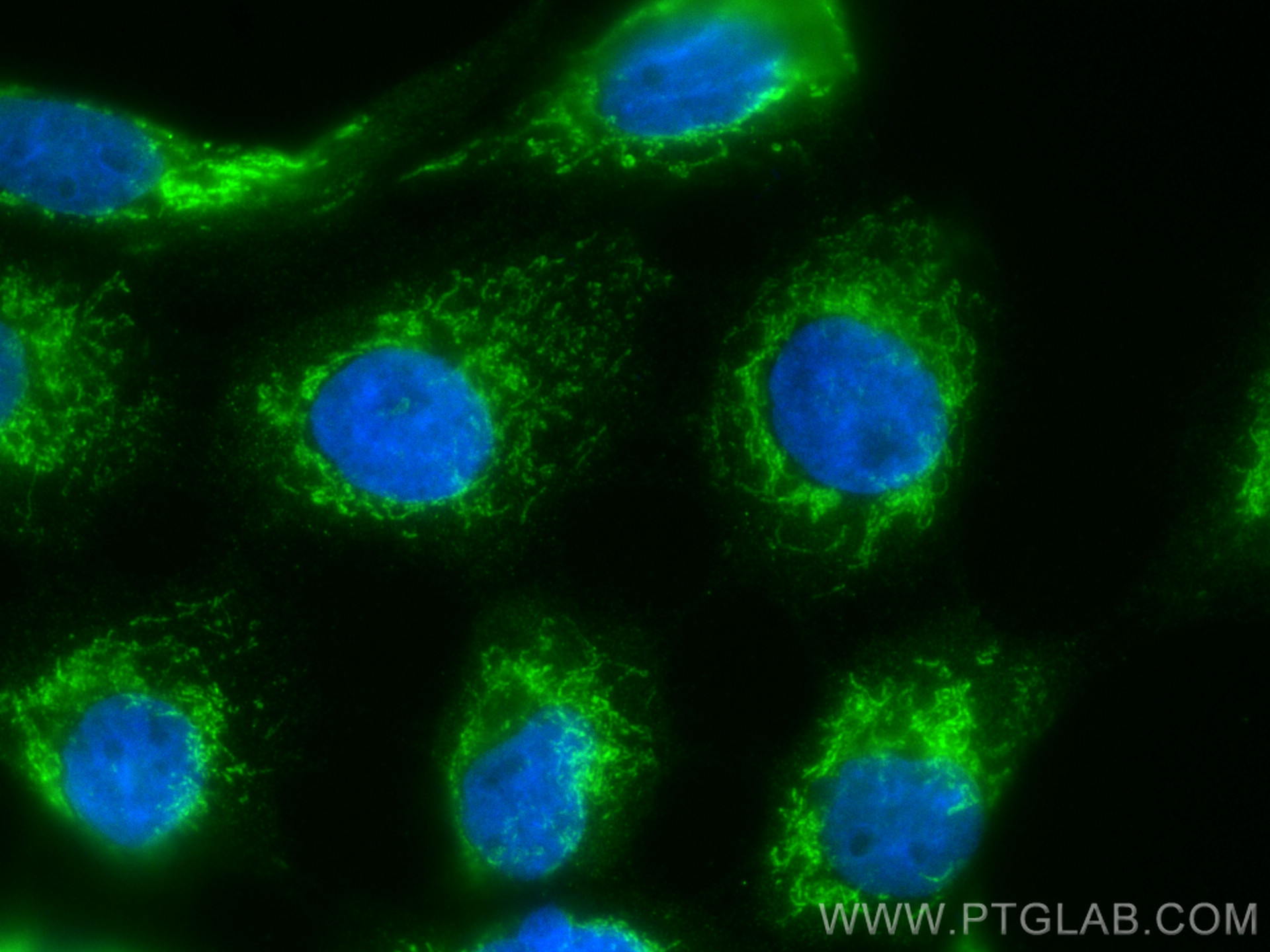 Immunofluorescence (IF) / fluorescent staining of A431 cells using CoraLite® Plus 488-conjugated CHCHD4 Polyclonal an (CL488-21090)