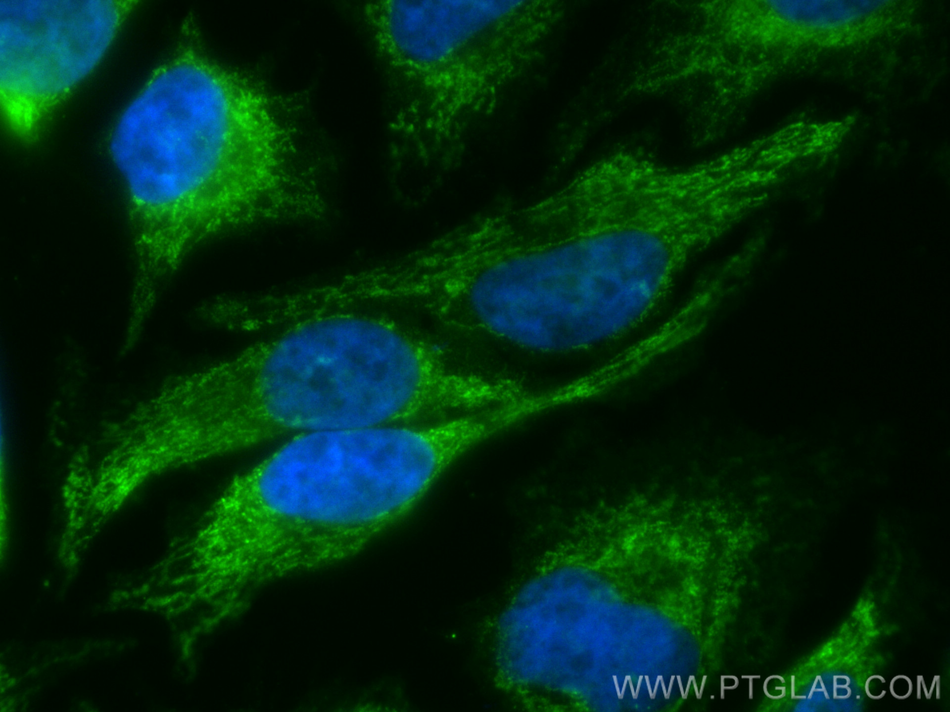 Immunofluorescence (IF) / fluorescent staining of HeLa cells using CoraLite® Plus 488-conjugated CHCHD4 Polyclonal an (CL488-21090)