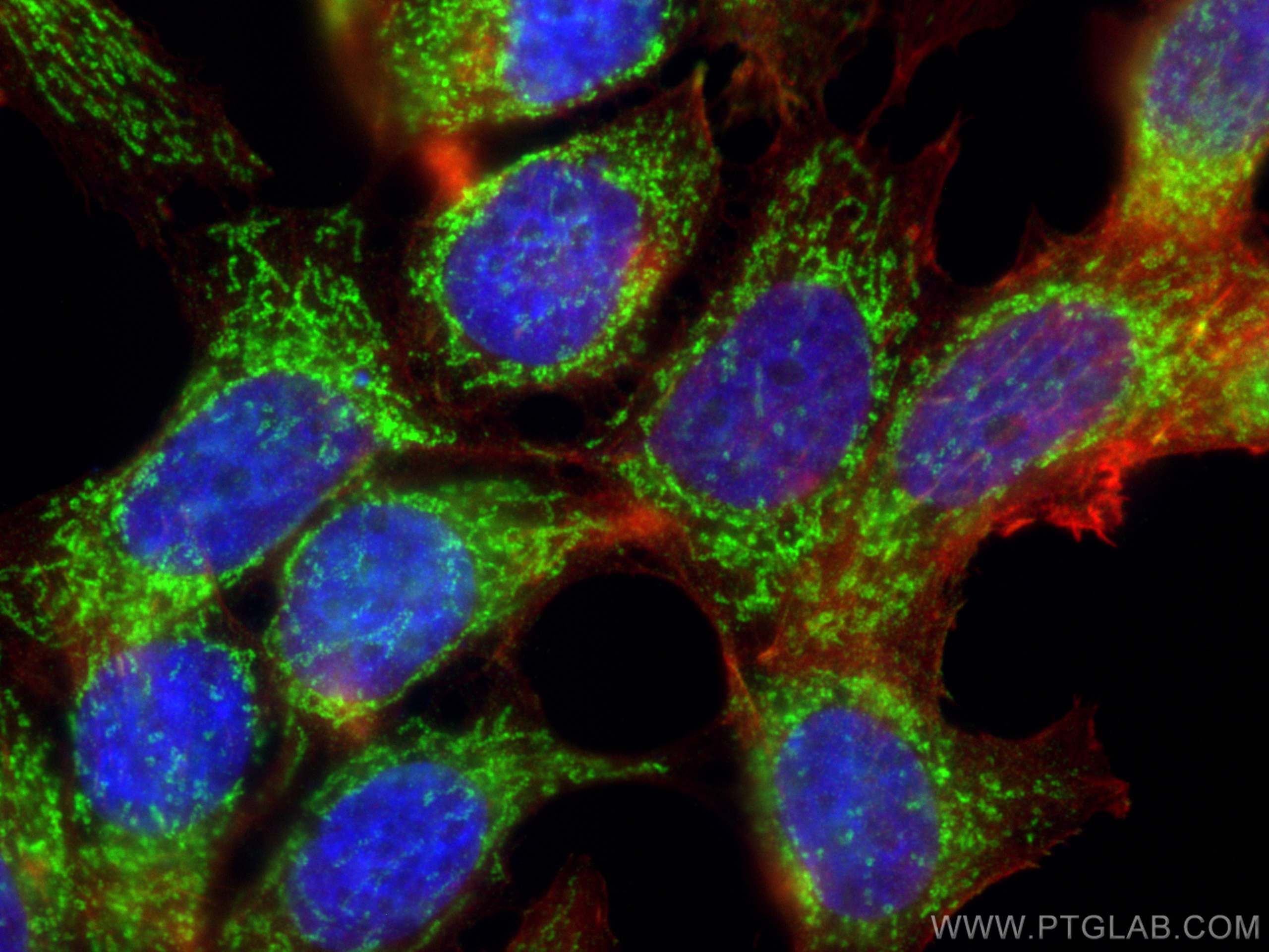 Immunofluorescence (IF) / fluorescent staining of MCF-7 cells using CHCHD5 Polyclonal antibody (25711-1-AP)