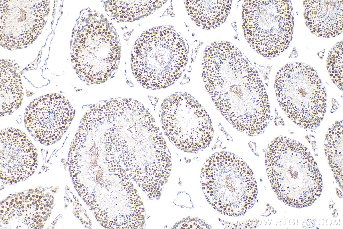 Immunohistochemistry (IHC) staining of mouse testis tissue using CHD2 Polyclonal antibody (21334-1-AP)