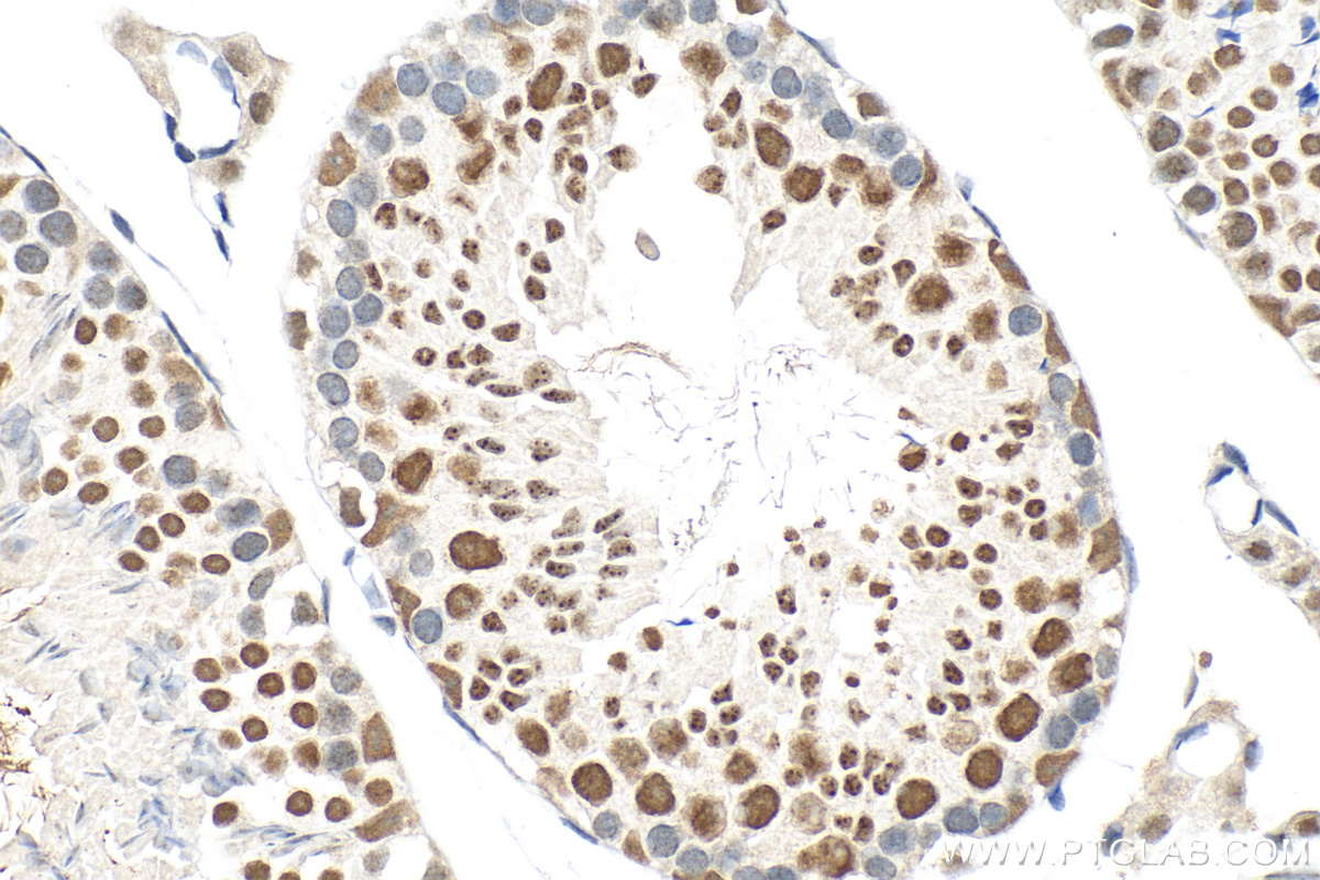 Immunohistochemistry (IHC) staining of mouse testis tissue using CHD2 Polyclonal antibody (21334-1-AP)