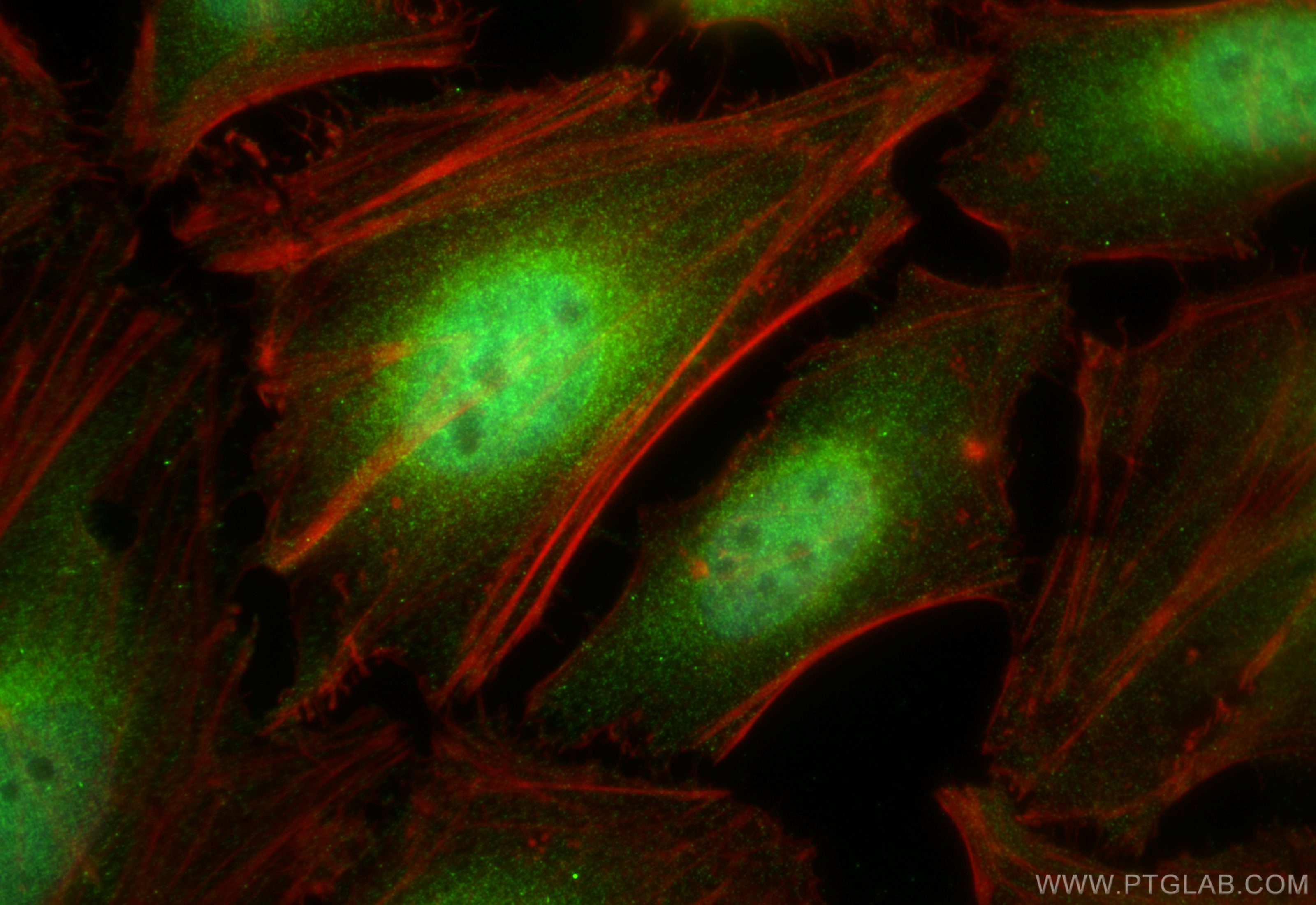 Immunofluorescence (IF) / fluorescent staining of Hela cells using CHD9 Polyclonal antibody (13402-1-AP)