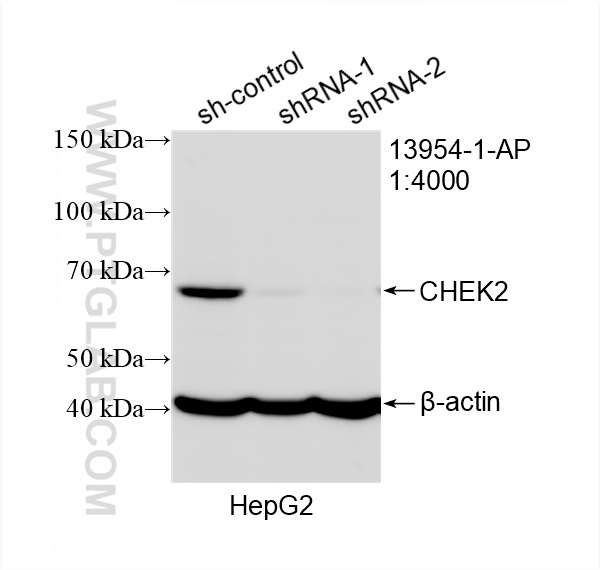 Western Blot (WB) analysis of HepG2 cells using CHEK2 Polyclonal antibody (13954-1-AP)