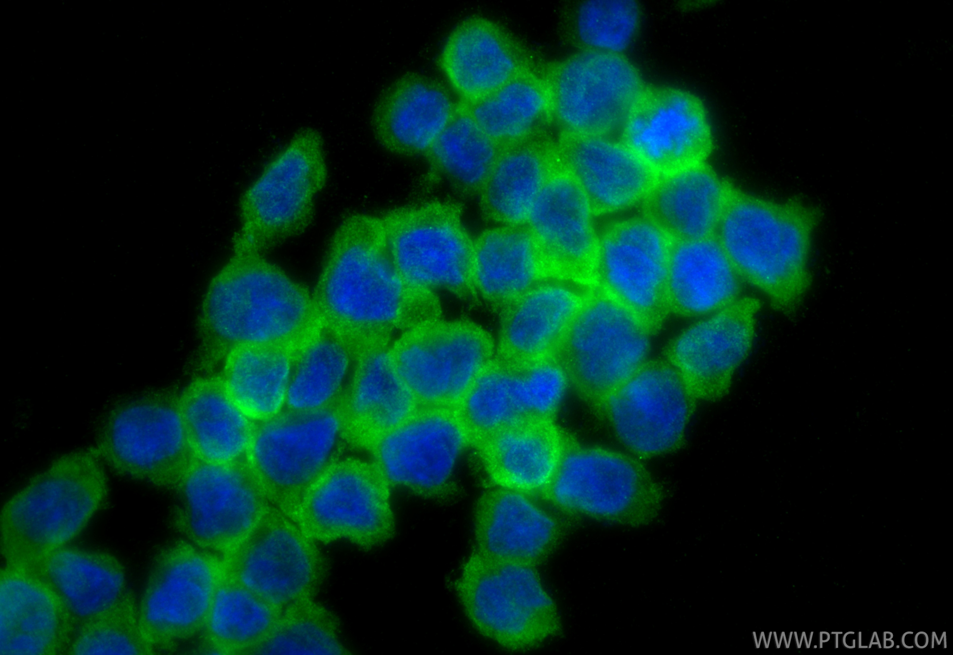 Immunofluorescence (IF) / fluorescent staining of THP-1 cells using CHI3L1/YKL40 Polyclonal antibody (12036-1-AP)