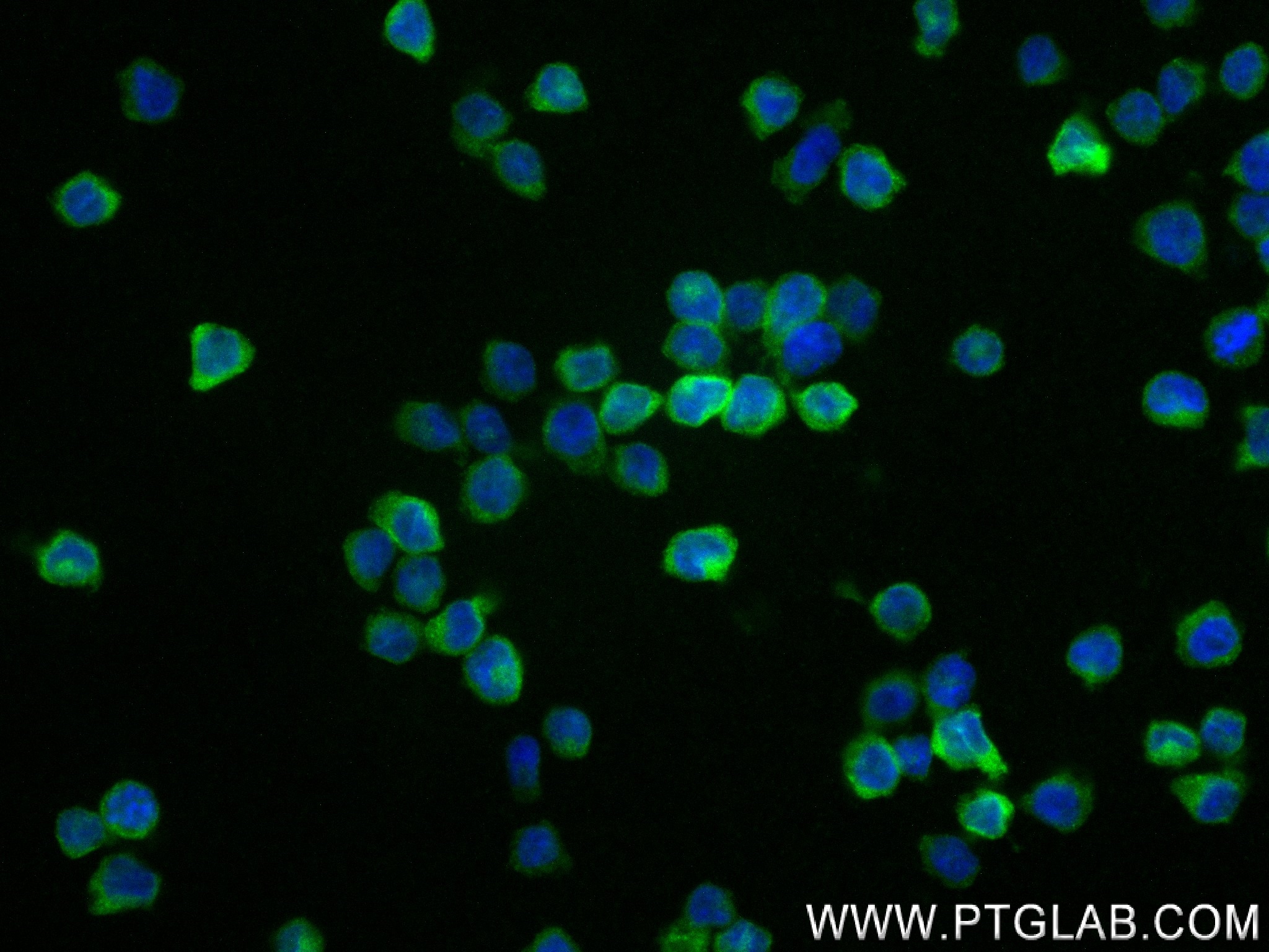 Immunofluorescence (IF) / fluorescent staining of THP-1 cells using CHI3L1 / YKL-40 Recombinant antibody (83685-4-RR)