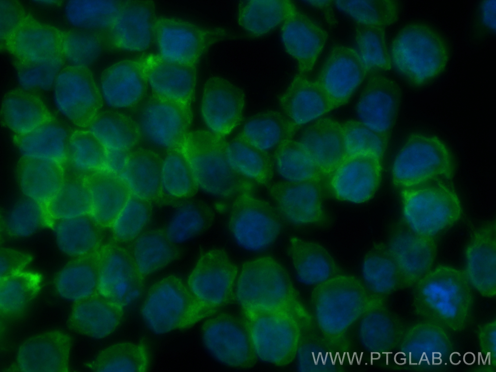 Immunofluorescence (IF) / fluorescent staining of THP-1 cells using CoraLite® Plus 488-conjugated CHI3L1/YKL40 Recombi (CL488-83685-4)