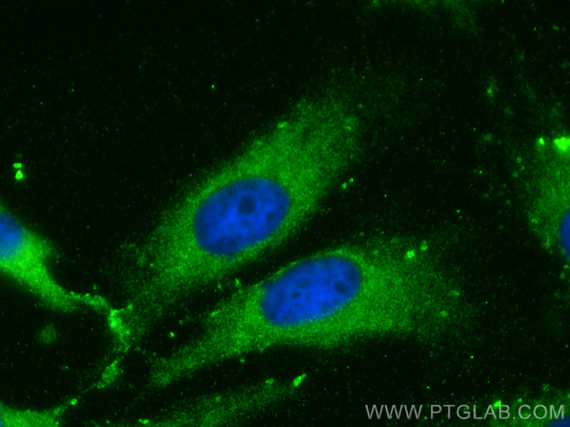 Immunofluorescence (IF) / fluorescent staining of HeLa cells using Choline Kinase Alpha Polyclonal antibody (13520-1-AP)