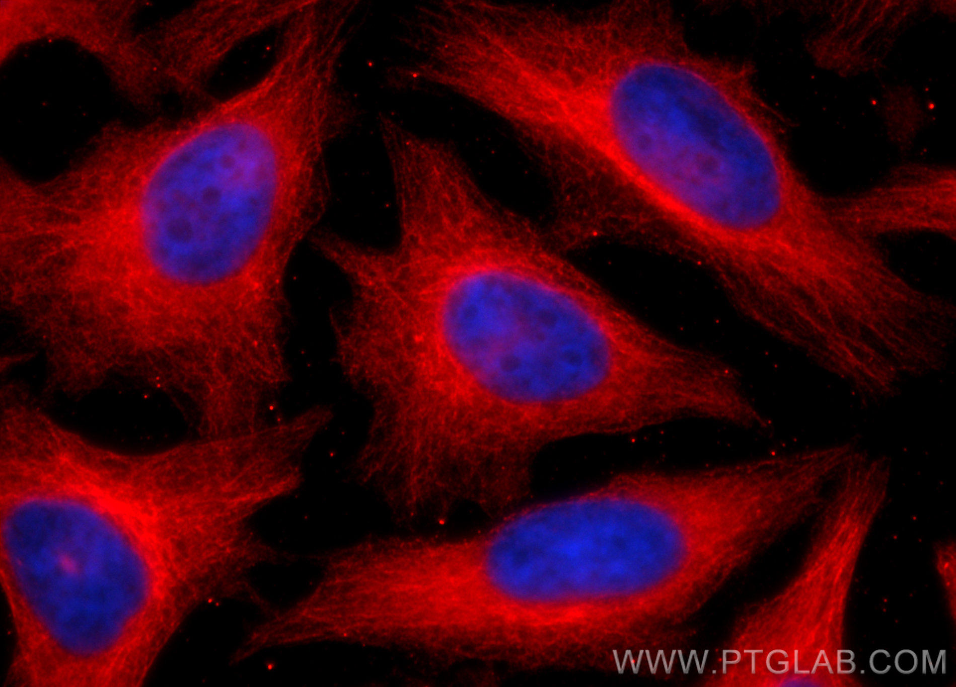 Immunofluorescence (IF) / fluorescent staining of HeLa cells using Choline Kinase Alpha Polyclonal antibody (13520-1-AP)