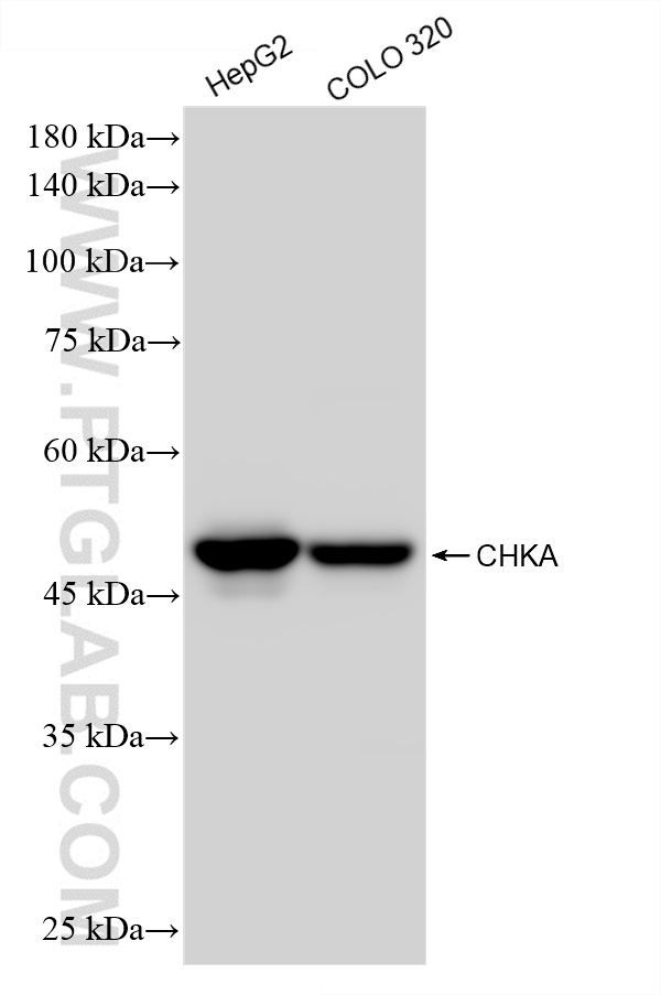 Western Blot (WB) analysis of various lysates using CHKA Recombinant antibody (84881-2-RR)