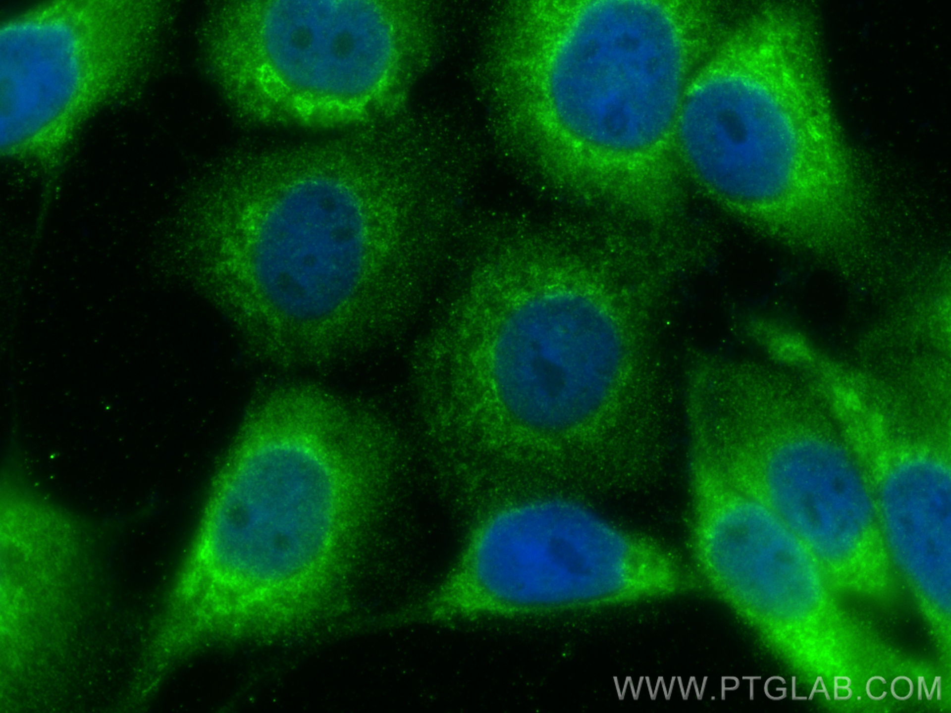 Immunofluorescence (IF) / fluorescent staining of A431 cells using CHM Polyclonal antibody (26251-1-AP)