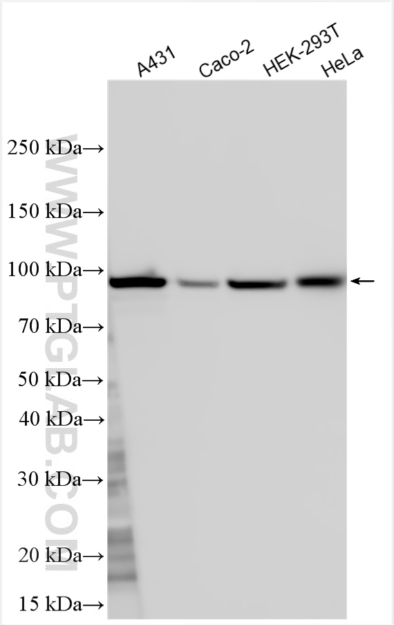 Western Blot (WB) analysis of various lysates using CHM Polyclonal antibody (26251-1-AP)