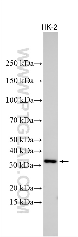 Western Blot (WB) analysis of various lysates using CHMP2A Polyclonal antibody (10477-1-AP)