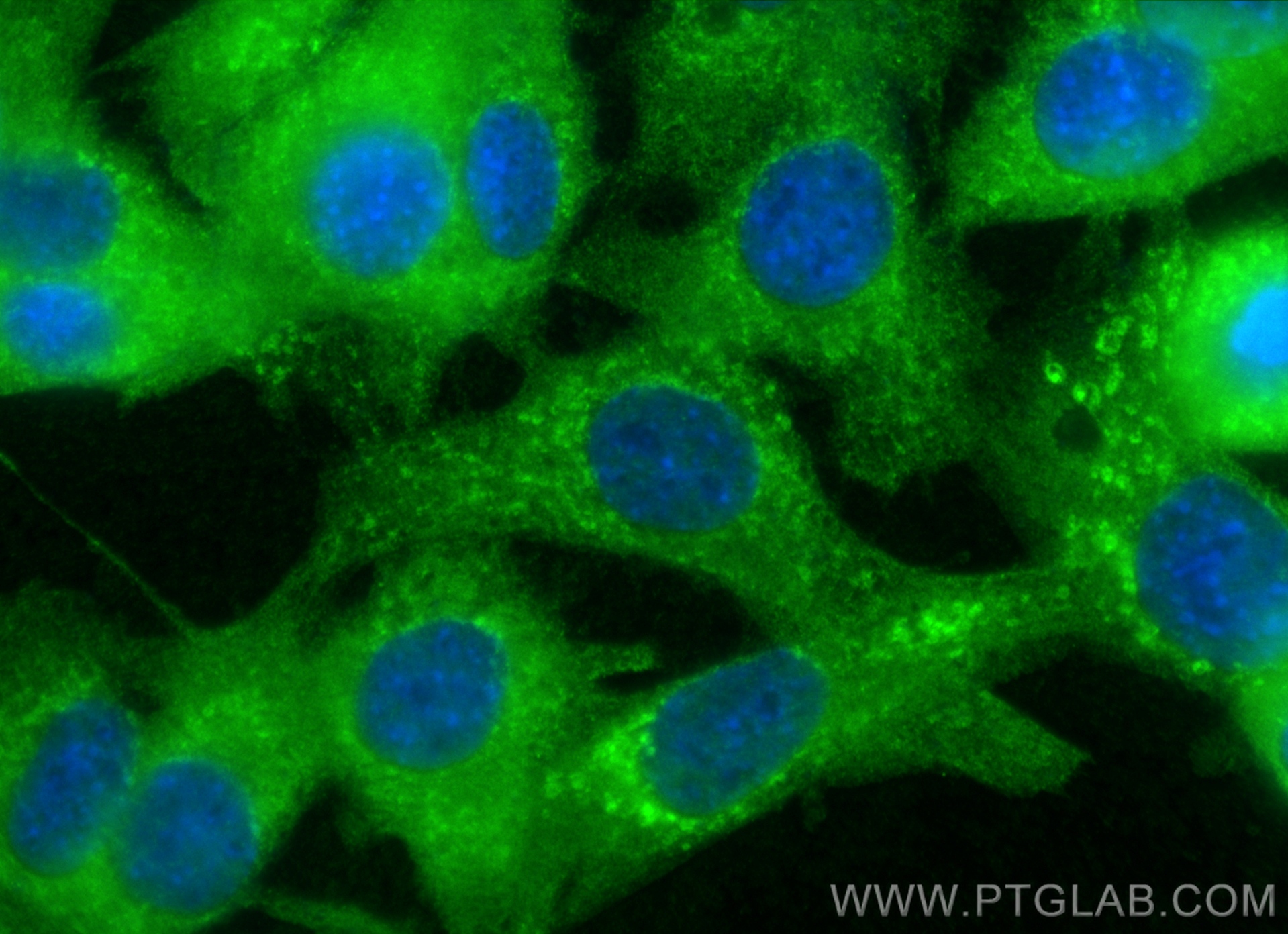 Immunofluorescence (IF) / fluorescent staining of C2C12 cells using CHMP4B Polyclonal antibody (13683-1-AP)