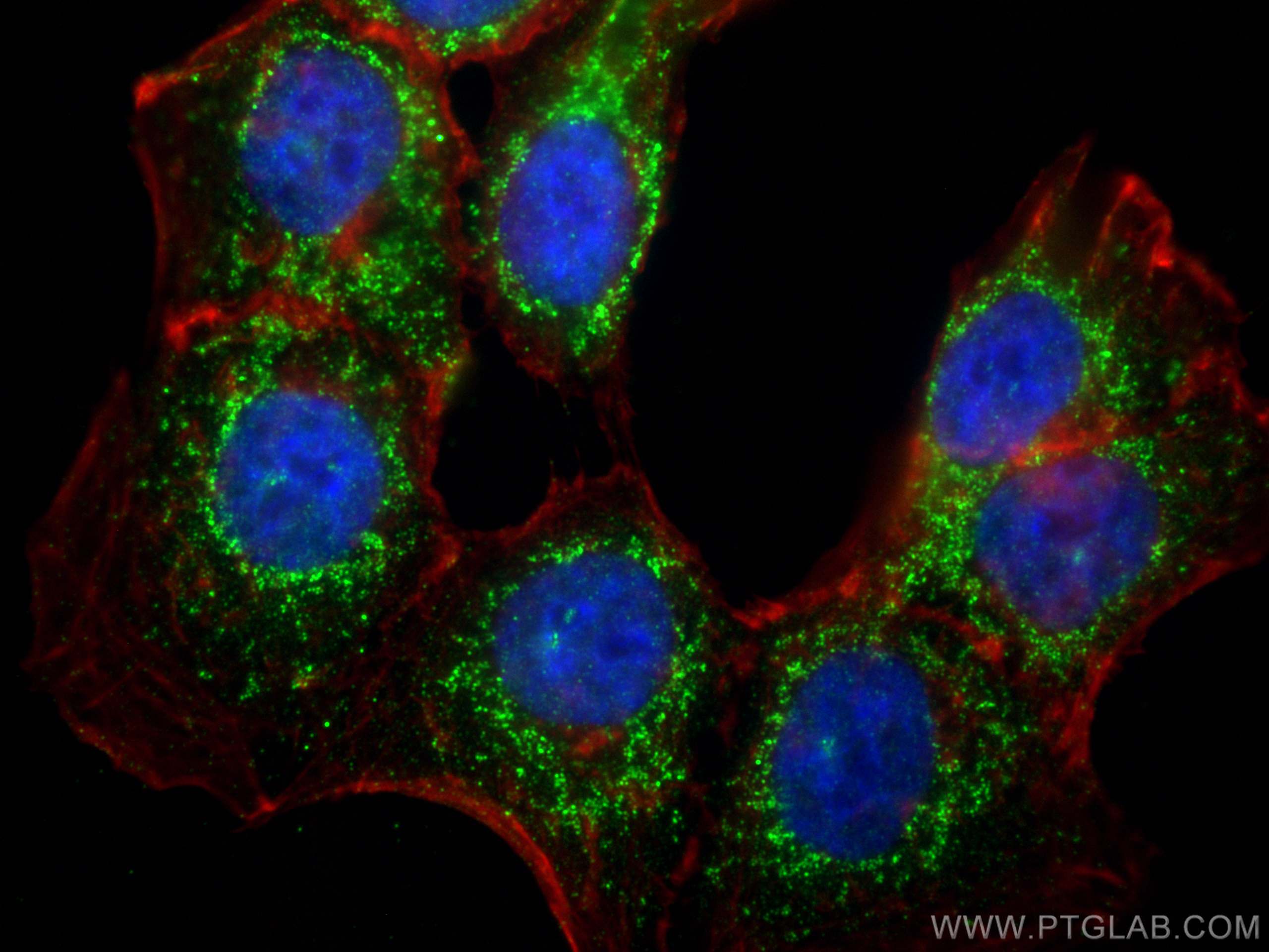 Immunofluorescence (IF) / fluorescent staining of HCT 116 cells using CHMP4B Monoclonal antibody (68811-1-Ig)