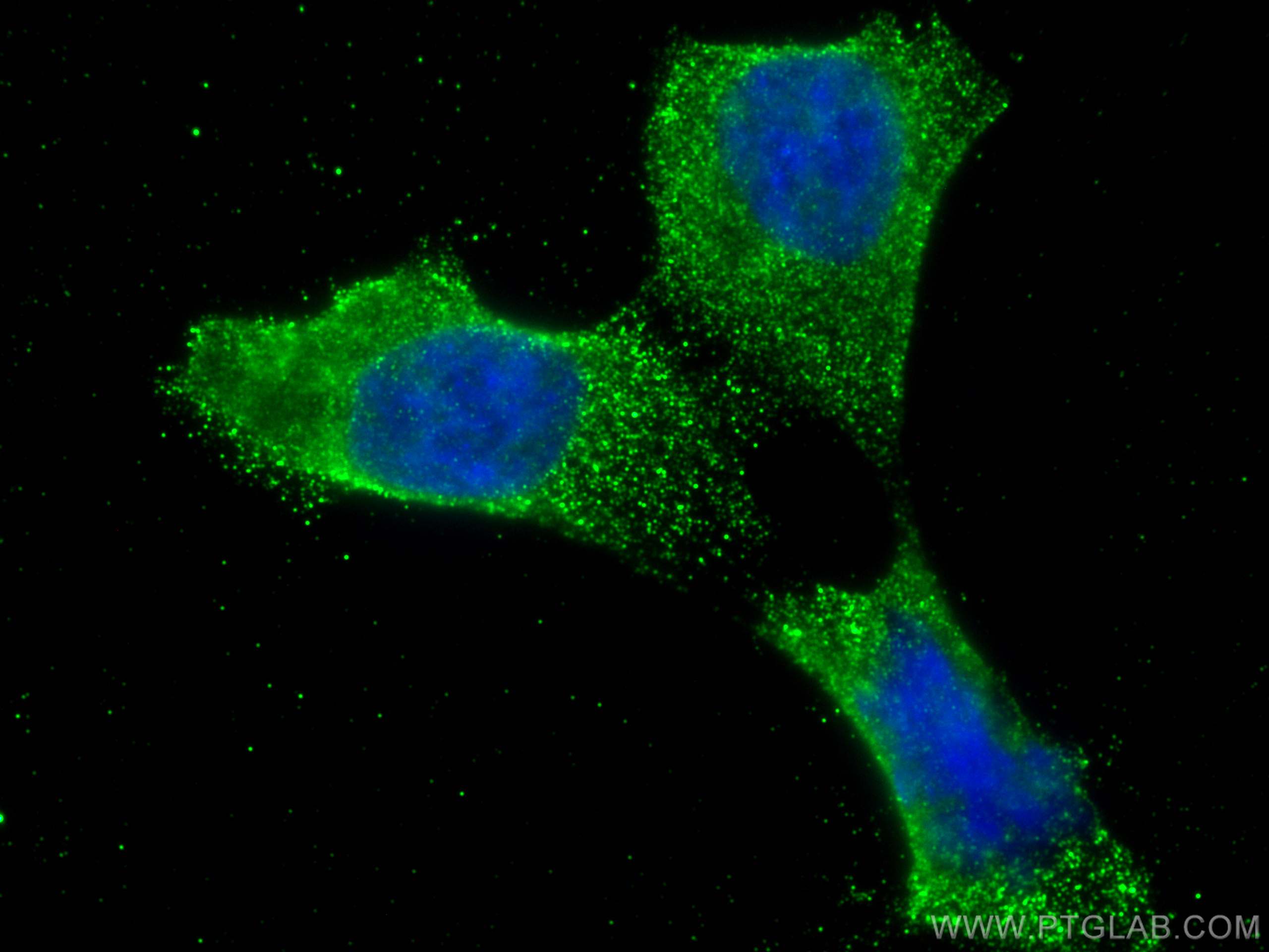 Immunofluorescence (IF) / fluorescent staining of HCT 116 cells using CHMP4B Monoclonal antibody (68811-2-Ig)