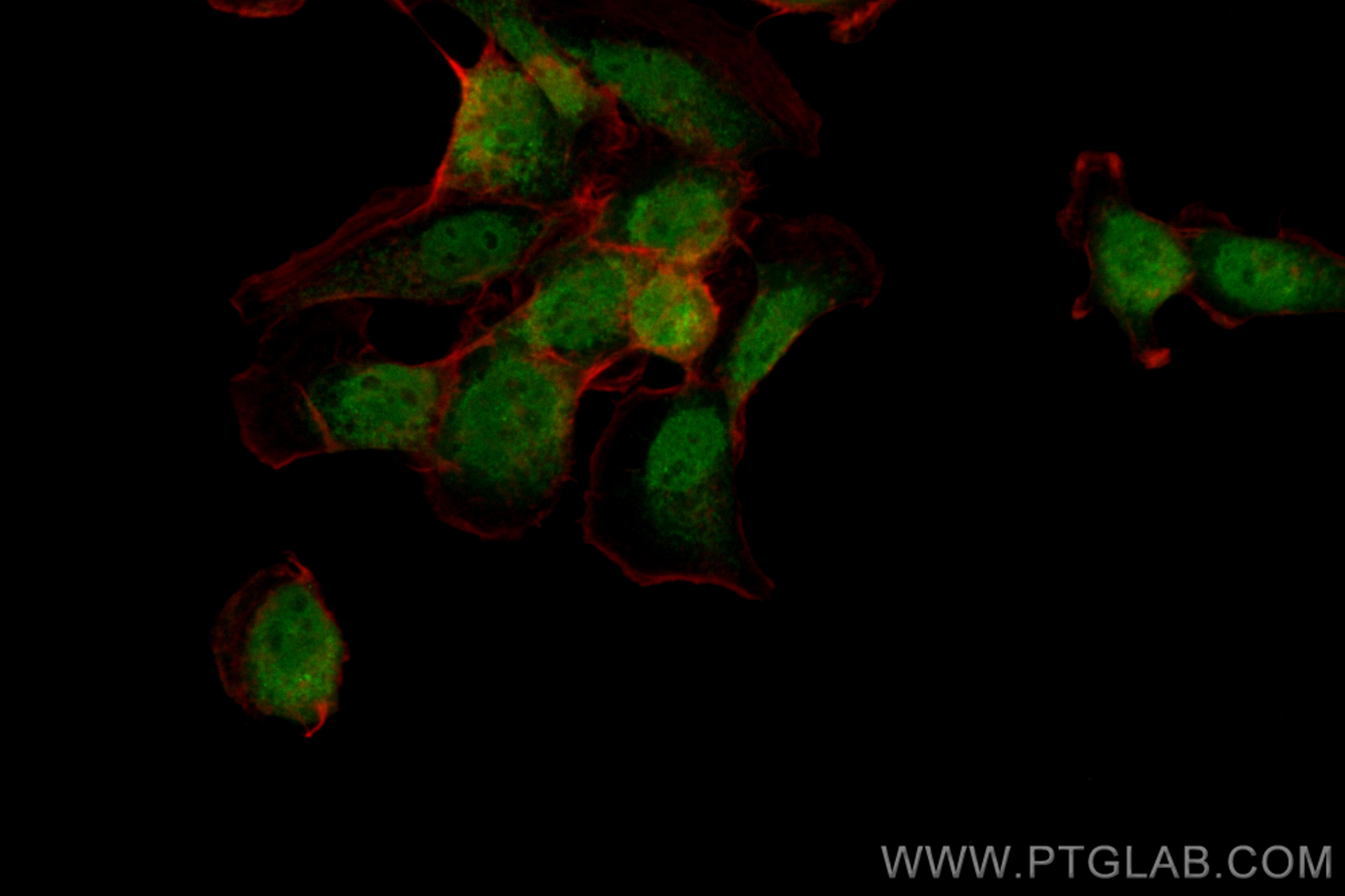 Immunofluorescence (IF) / fluorescent staining of A431 cells using CoraLite® Plus 488-conjugated CHMP7 Polyclonal ant (CL488-16424)