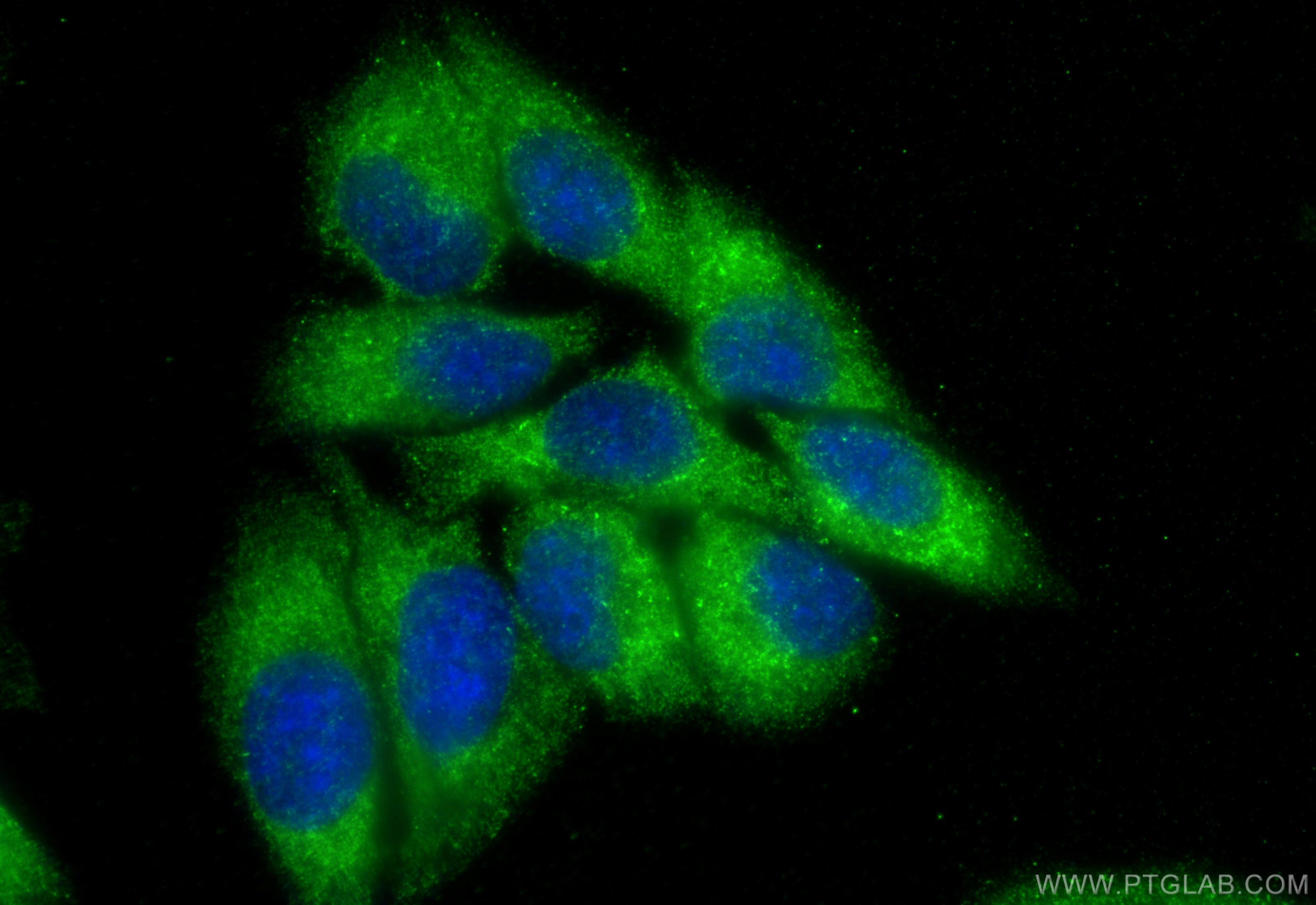 Immunofluorescence (IF) / fluorescent staining of HepG2 cells using CHPF N-terminal Polyclonal antibody (23953-1-AP)