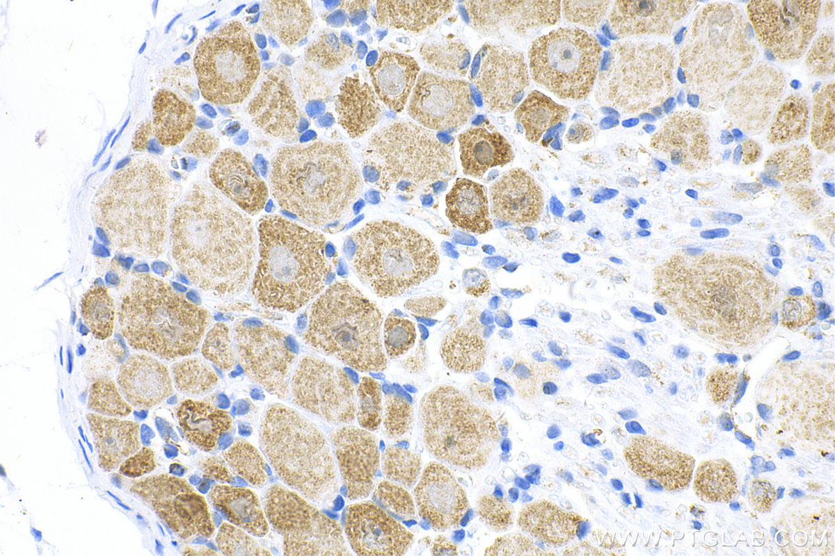 Immunohistochemistry (IHC) staining of rat dorsal root ganglion tissue using CHRNA7 (48 kDa) Recombinant antibody (82848-3-RR)