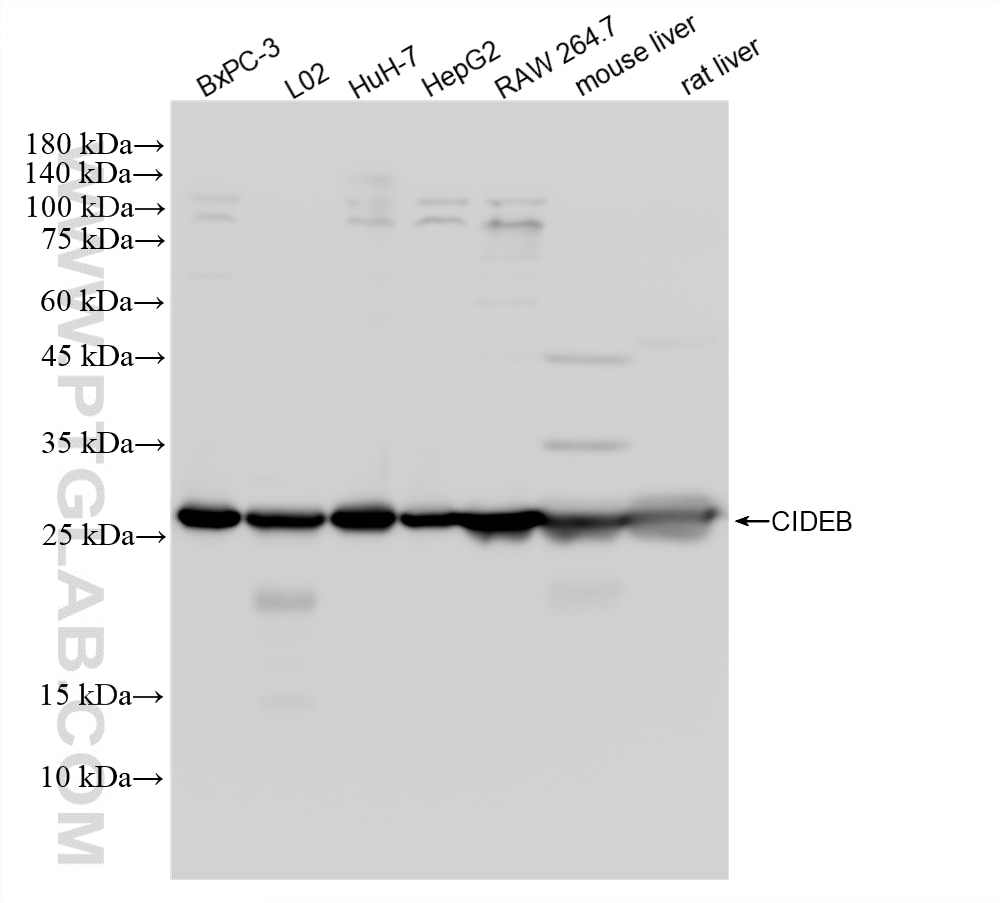 Western Blot (WB) analysis of various lysates using CIDEB Recombinant monoclonal antibody (88087-1-RR)