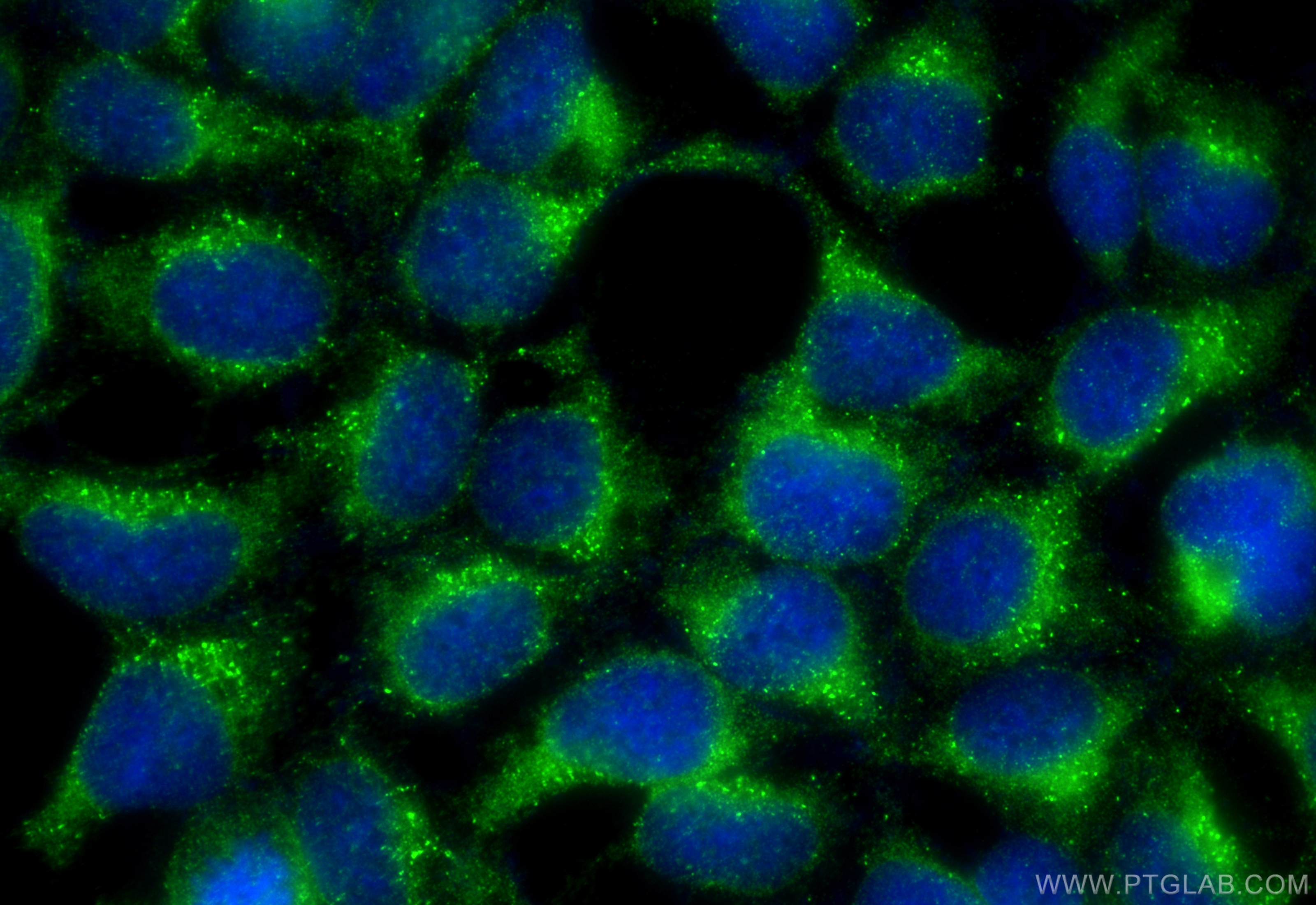 Immunofluorescence (IF) / fluorescent staining of HEK-293 cells using CILP2 Polyclonal antibody (11813-1-AP)