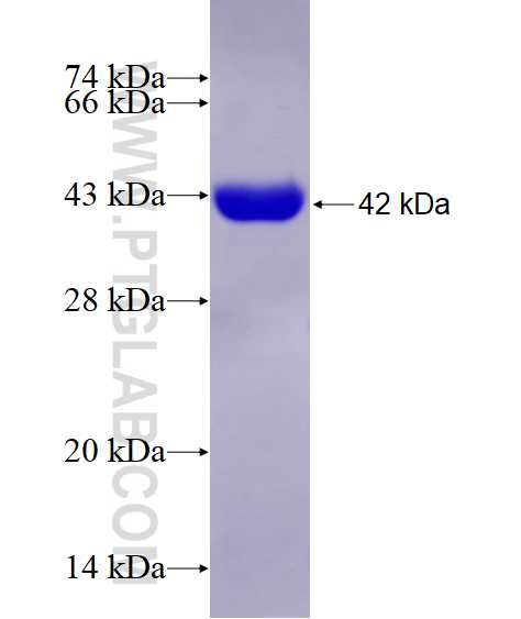 CIN85 fusion protein Ag28776 SDS-PAGE