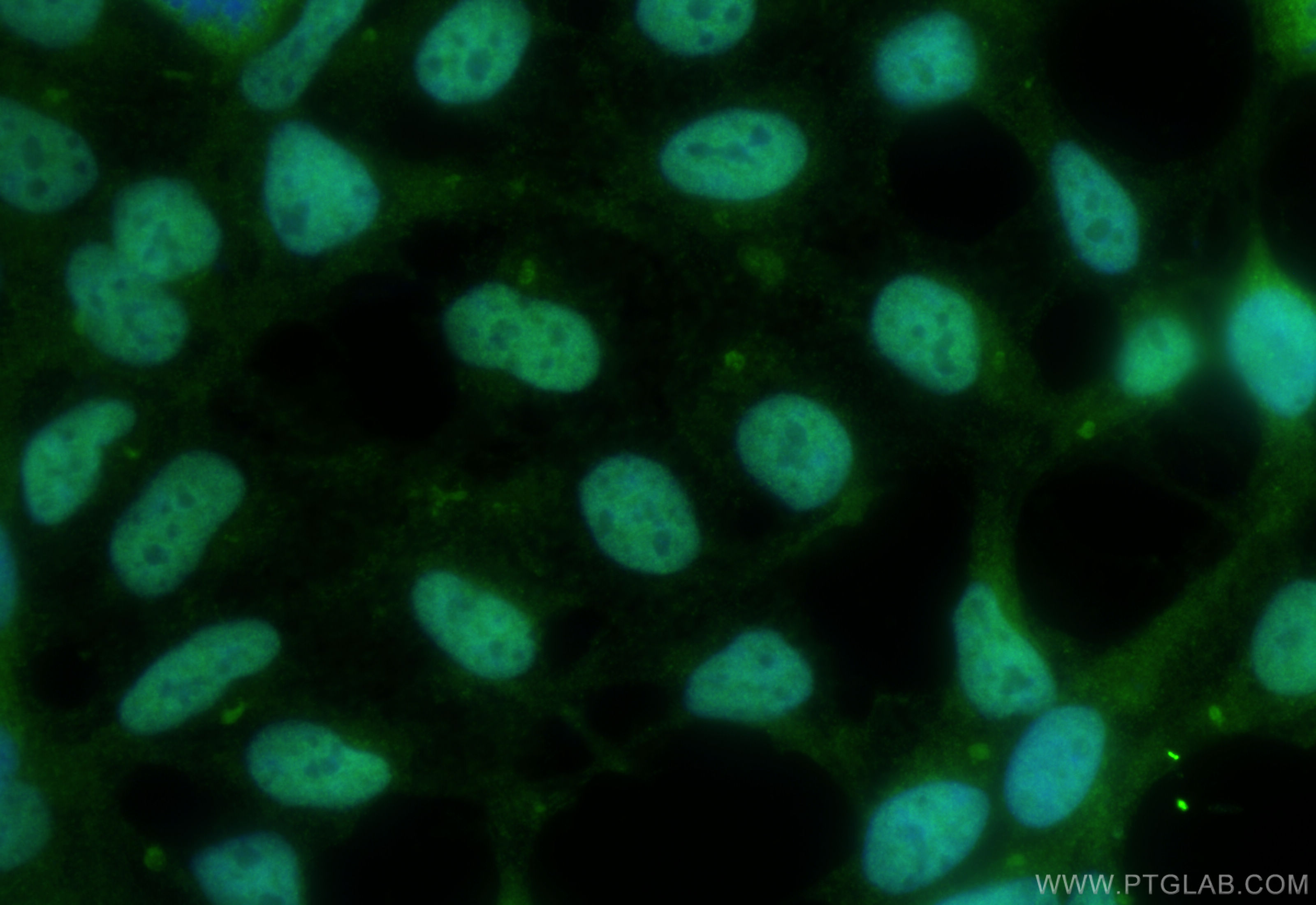 Immunofluorescence (IF) / fluorescent staining of HEK-293 cells using CIRBP Polyclonal antibody (10209-2-AP)