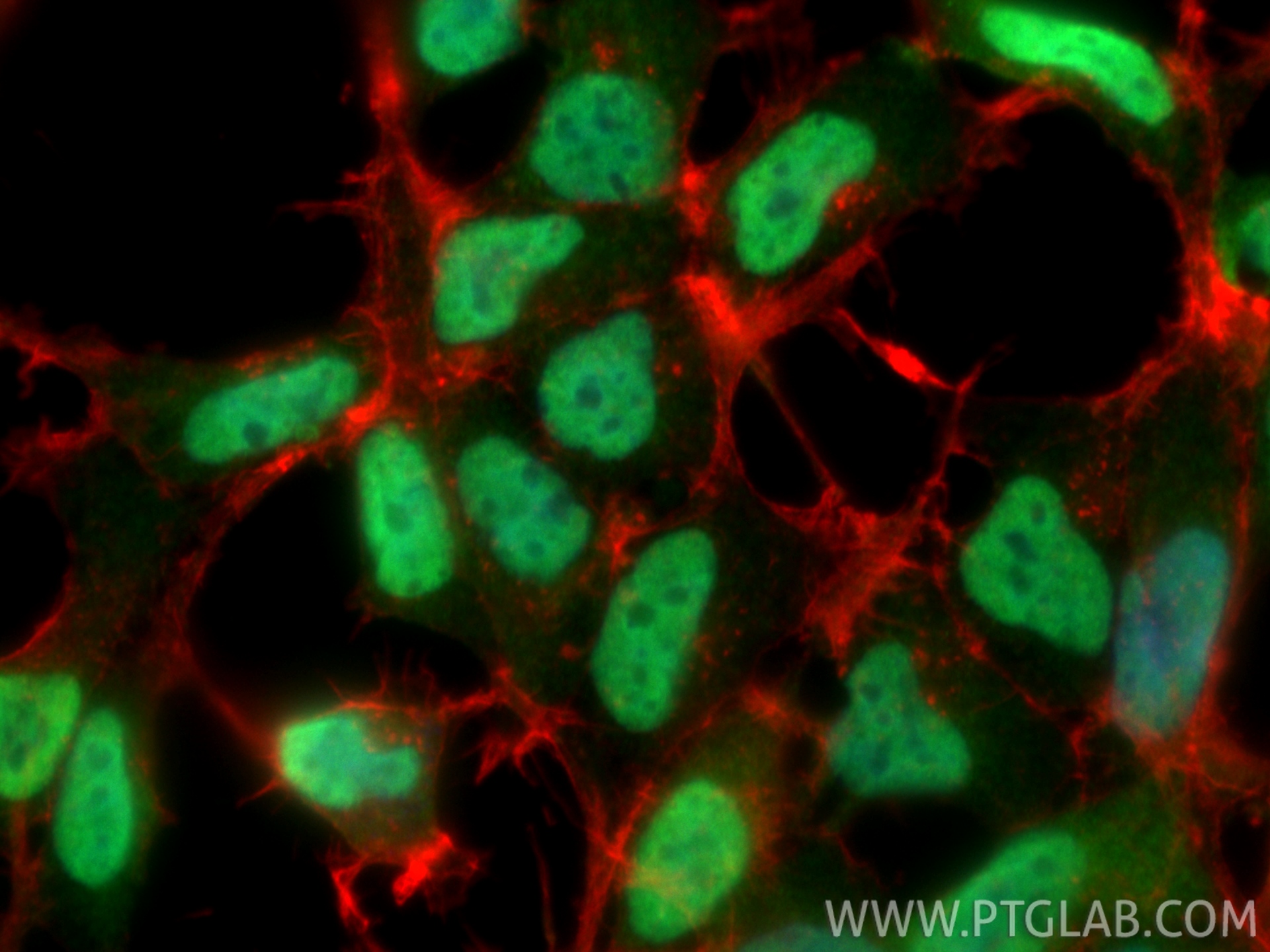 Immunofluorescence (IF) / fluorescent staining of HEK-293 cells using CIRBP Polyclonal antibody (10209-2-AP)