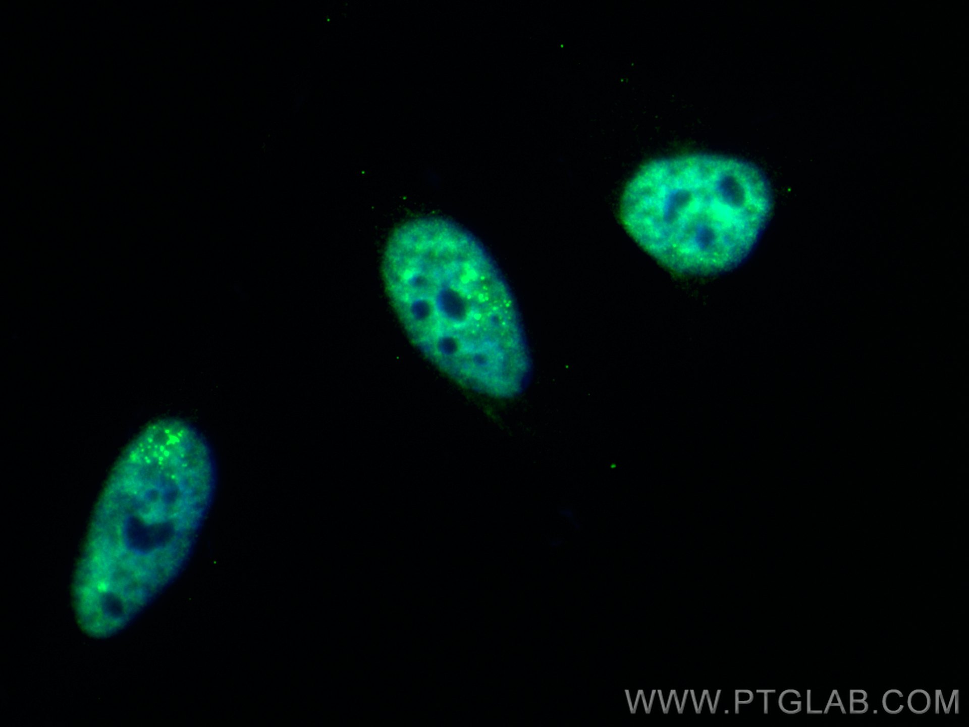 Immunofluorescence (IF) / fluorescent staining of HeLa cells using CoraLite® Plus 488-conjugated CIRBP Polyclonal ant (CL488-10209)