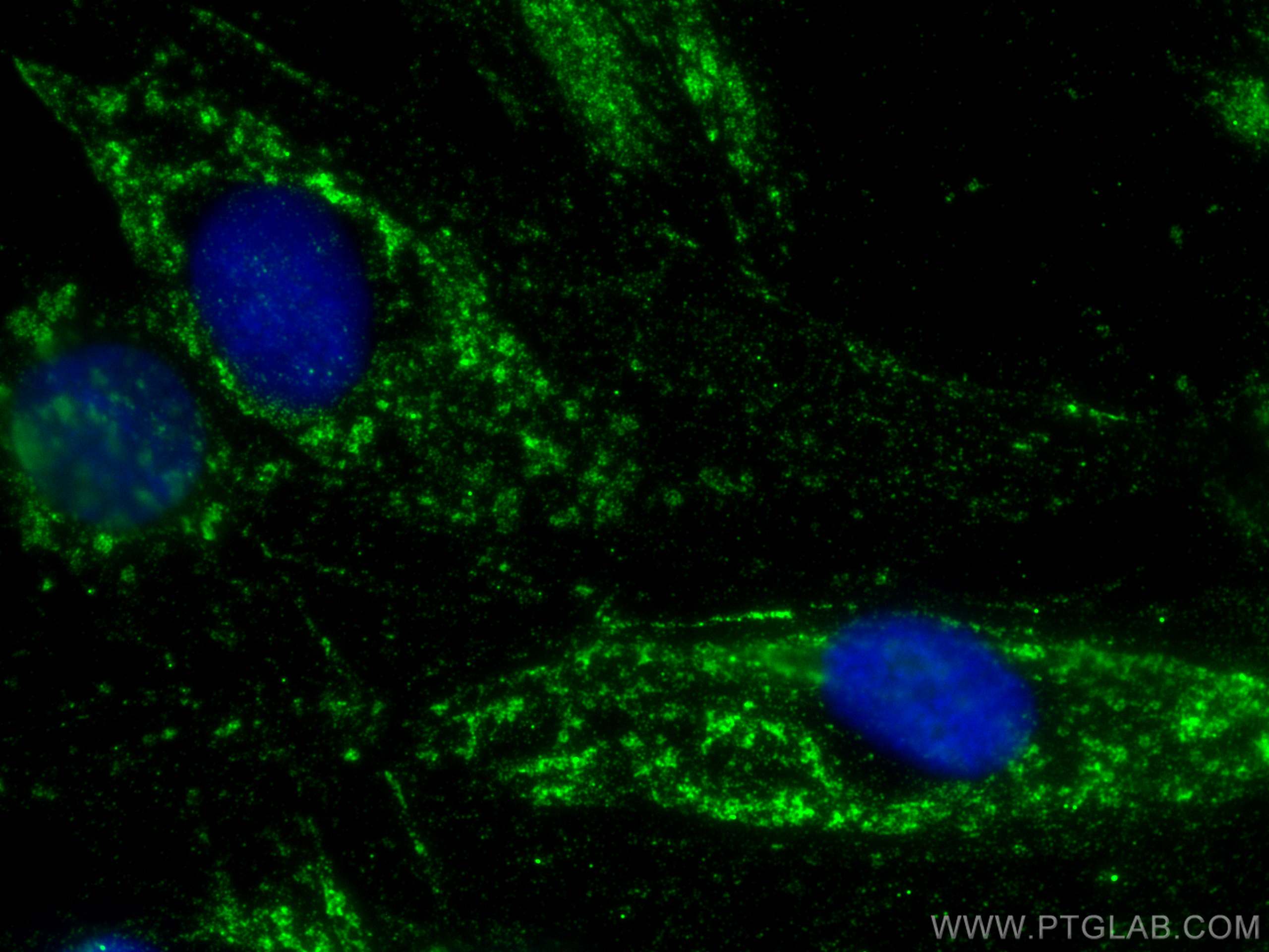 Immunofluorescence (IF) / fluorescent staining of H9C2 cells using CISD1 Monoclonal antibody (68030-1-Ig)